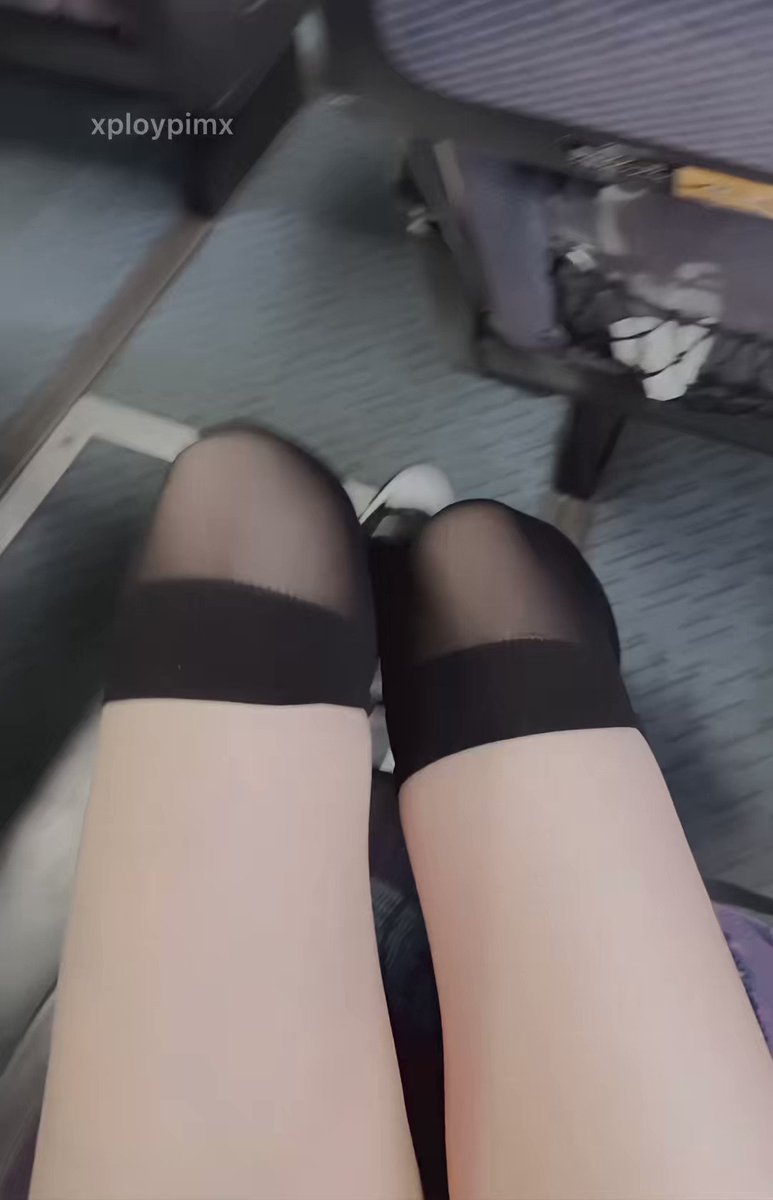 Sun burn  ☀️ https://t.co/yf4AbyKKWY