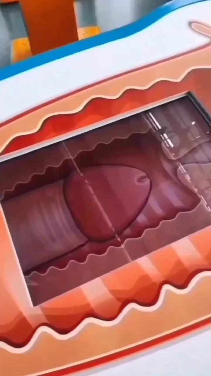Name this procedure 🔬 https://t.co/quUelozbJf