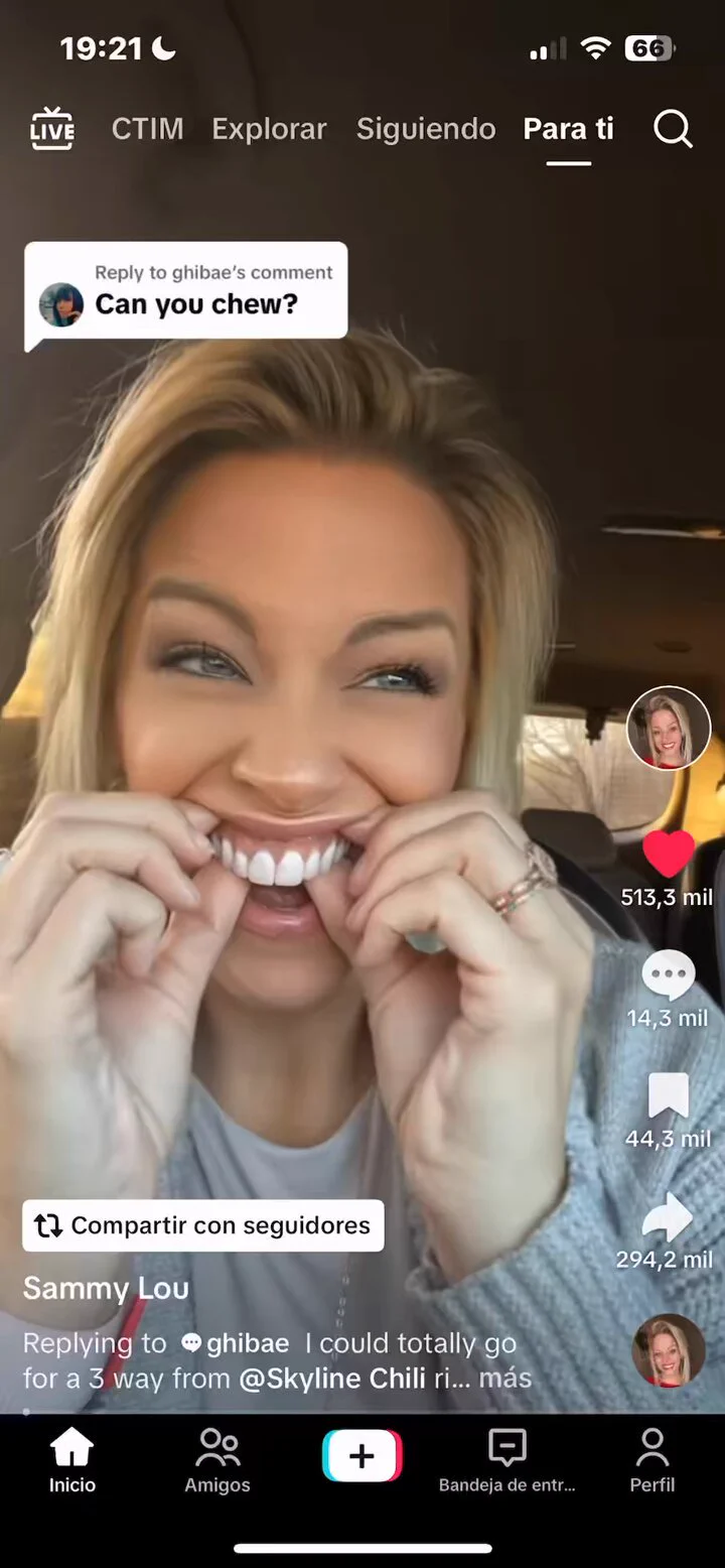 “Influencer”:Porque así te engañan, tiene todos tornillos metálicos en las cavidades de los dientes https://t.co/6fGFgLI3al