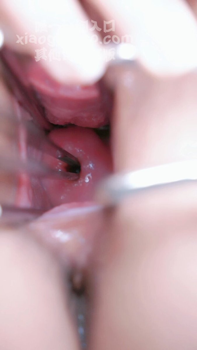 #子宫调教扩张
调教子宫的玩法真的好新奇唉🤩，宫颈上的肌肉捏起来软软弹弹的像个大软糖😍😍。虽然没生过宝宝，但是第一次扩宫颈就扩开了一个小洞洞，再用震动棒插子宫能插进一厘米深度，并且还有微微的爽感和酸痛感🥹（已仔细消毒， 请勿模仿）
@ToBulaer @KawasawaSen @BulmaList @ToBuerma https://t.co/eTtUTXKKQS