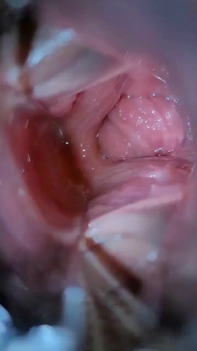 让你们看看淫水是怎么一点点从小穴里分泌出来的 https://t.co/V8wMFaimfN