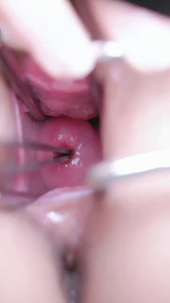 #子宫调教扩张调教子宫的玩法真的好新奇唉🤩，宫颈上的肌肉捏起来软软弹弹的像个大软糖📷 😍。虽然没生过宝宝，但是第一次扩宫颈就扩开了一个小洞洞，再用震动棒更多精彩完整内容点击主页资料进入电报群观看 https://t.co/C6SP7iCsQe