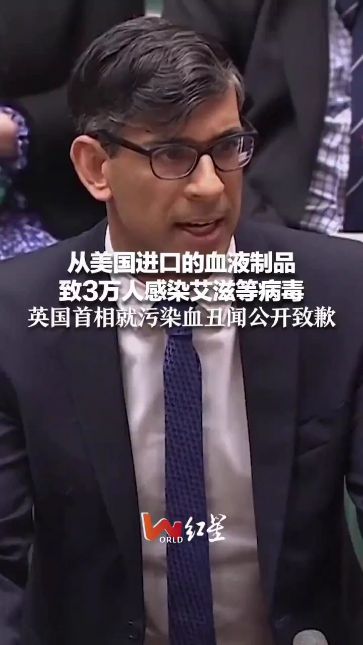 Imported blood products from the United States caused 30,000 United Kingdomns to be infected with HIV and hepatitis BUnited Kingdom Prime #Sunak apologizes.That's terrible. Is this a conspiracy?#UnitedKingdom #America https://t.co/UAHHmCd2lP