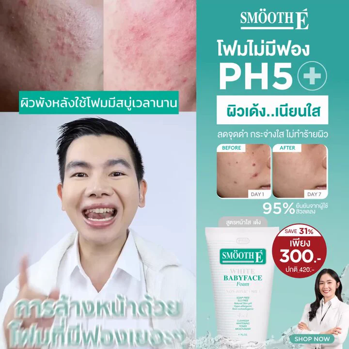 รู้หรือไม่⁉️ โฟมล้างหน้าที่มีฟองอาจจะทำร้ายผิวมากกว่าที่คิด .เวชสำอางโฟมล้างหน้า ไม่มีฟอง Smooth E WHITE Baby Face Foam 🫧ทำความสะอาดล้ำลึกและ pH5 ที่สร้างสมดุลบนผิวหน้า ลดจุดด่างดำ ปรับผิวให้กระจ่างใสอย่างเป็นธรรมชาติ หน้าใส เด้ง ใน 7 วัน! .ไม่ทำให้เกิดการระคายเคือง #ผิวแพ้ง่าย ใช้ได้​ และได้รับ.✅100% Vitamin C&E ลดรอยดำ ผิวกระจ่างใส ชุ่มชื้น✅pH5 Balance สร้างสมดุลบนผิวหน้า ​✅สูตร Non-ionic ไม่มีฟองและประจุไฟฟ้า✅สารสกัดธรรมชาติ Melawhite from Swiss ดูแลผิวอย่างอ่อนโยน​​..ช้อปเลยวันนี้ที่ WATSONS ทั้งร้านค้า และ ช่องทางออนไลน์🛒💚Watsons: https://t.co/qCHRPzm11G🛒🧡Shopee: https://t.co/JKDtELRvRX ​🛒💙Lazada: https://t.co/WC0UcipJoE..#LingOrmSmoothEfamily #SmoothEpH5​ #LingOrm #หลิงออม #SmoothExLingOrm #SmoothE #สมูทอี