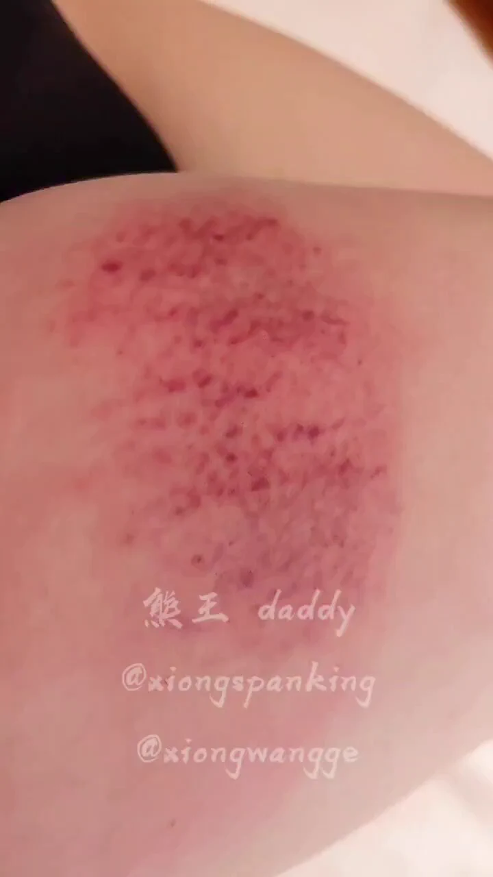 ⭕️ 这是 绯红色的拍印回忆
#广州 #SP #男主 #实践 #daddy  @wqganenshi_ @Haosehou @eggroll_tea @007share @tbzt2024 @Hexiansheng0031 https://t.co/cAVOTGoYpD