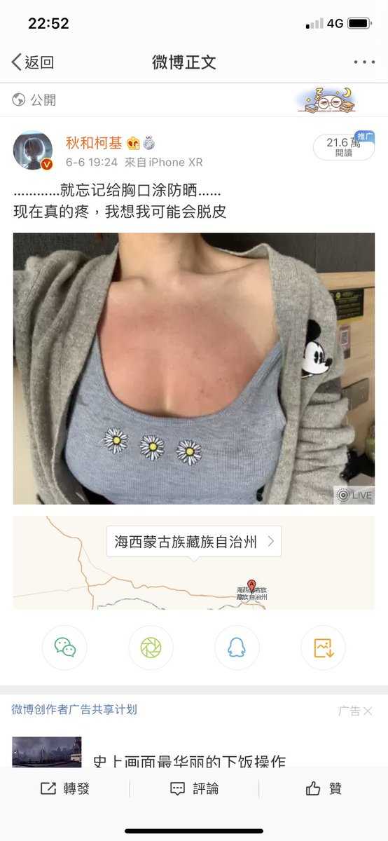 笑拉了，你是什么单细胞生物别人说什么你都马上相信。你🐴没了你知道吗？你信吗？
微博发的内容稍微翻几张就看到我晒伤当天的照片还能逼逼赖赖呢。 https://t.co/H1bjmkVdp8