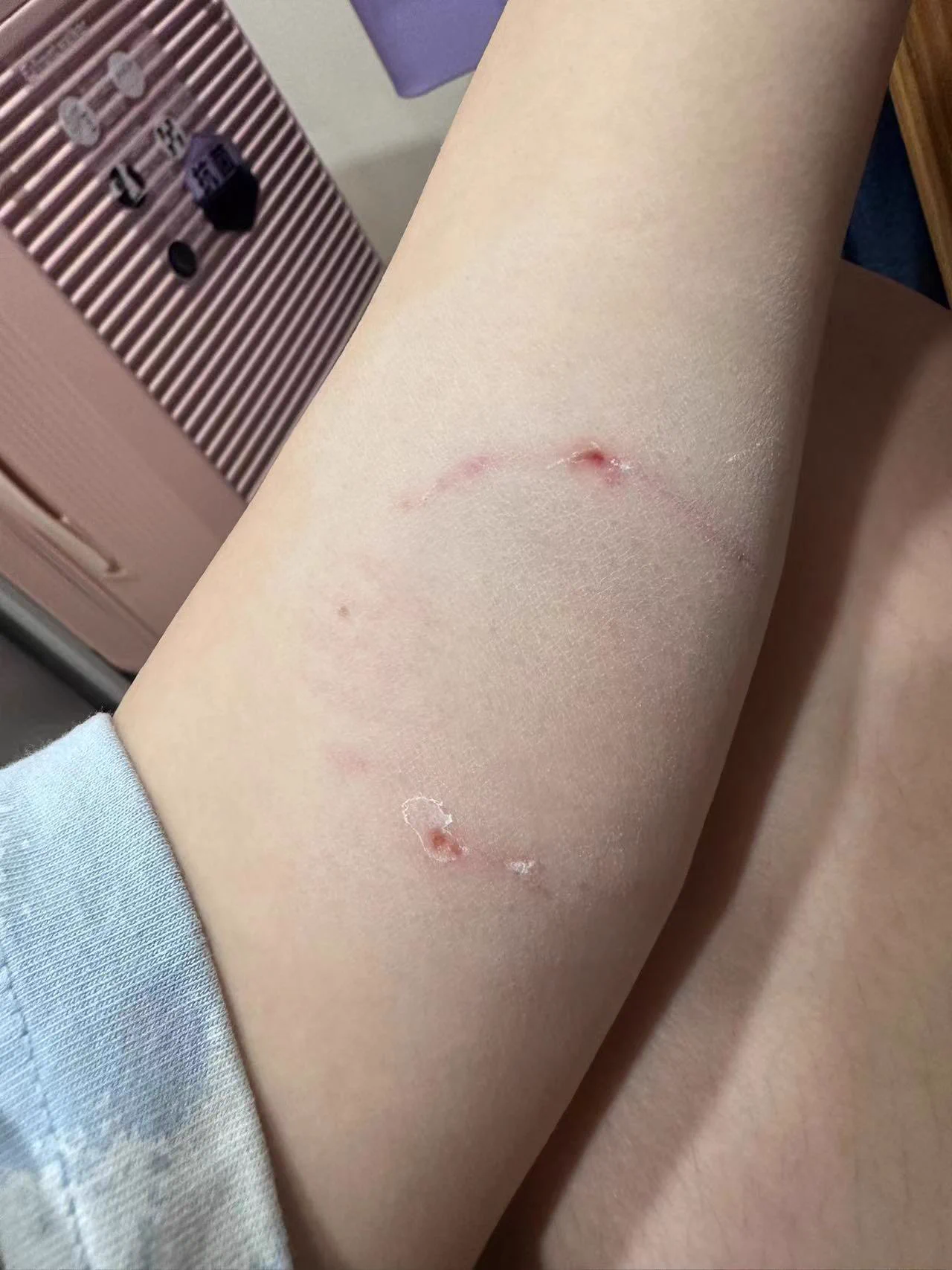 天天调狗昨天被他妈狗咬了😭😭 https://t.co/2lhLJq5CSB
