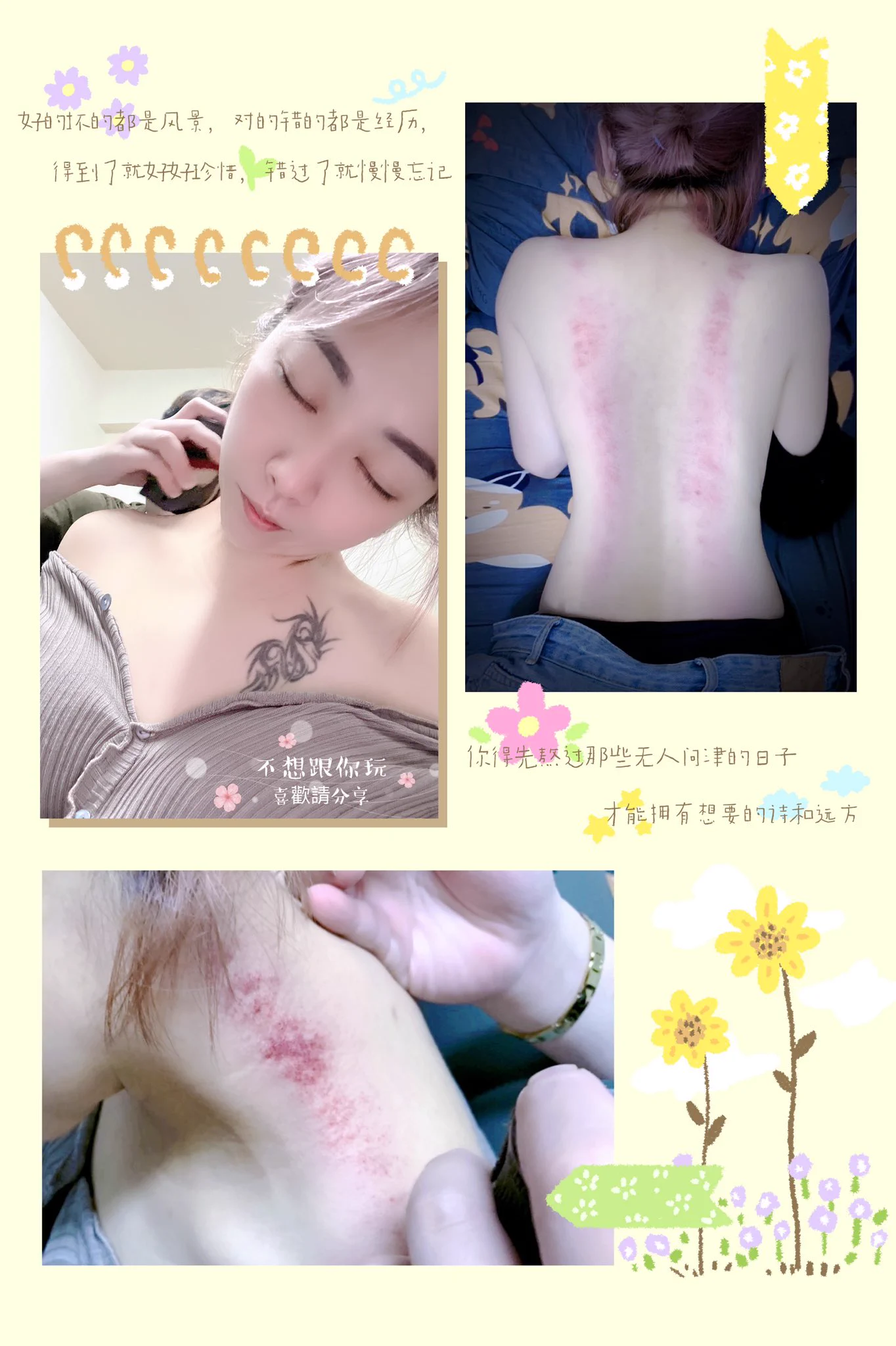 天氣熱到想吐 直接請人幫忙刮痧 甘苦😰😰😰 https://t.co/2TX6AzU5f7