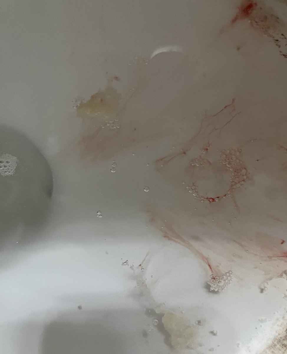 真的痛到無法好好睡，咳到吐出來喉嚨都是血 https://t.co/R6KZwPIOae