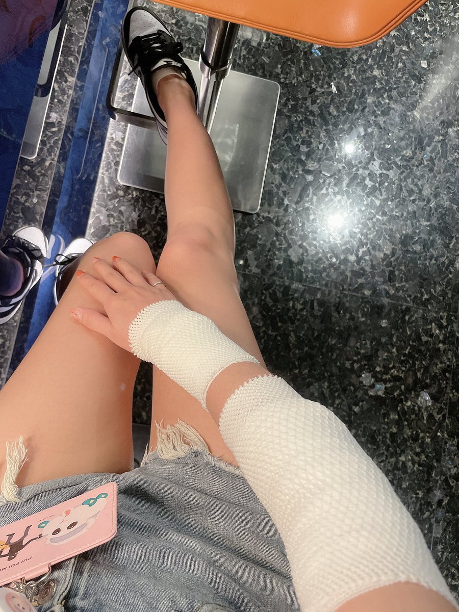 這個雨是在替我哭泣嗎？

我不是雷殘
是筋拉傷發炎
又針灸又電療又敷藥
痛😭😭😭

還是要跟我的腿拍一張(˶‾᷄ ⁻̫ ‾᷅˵) https://t.co/ByN35QGgZ2