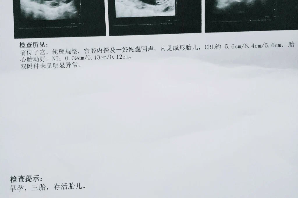 多子多福，恭喜呀，妈蛋的大家都不说别人才不管是不是你这个亲爹生的呢！很难得啦，老鸡巴们种子肯定不好啦，但是你家的地好呀，坐等开花结果啦！ https://t.co/s6ieSuzVY1