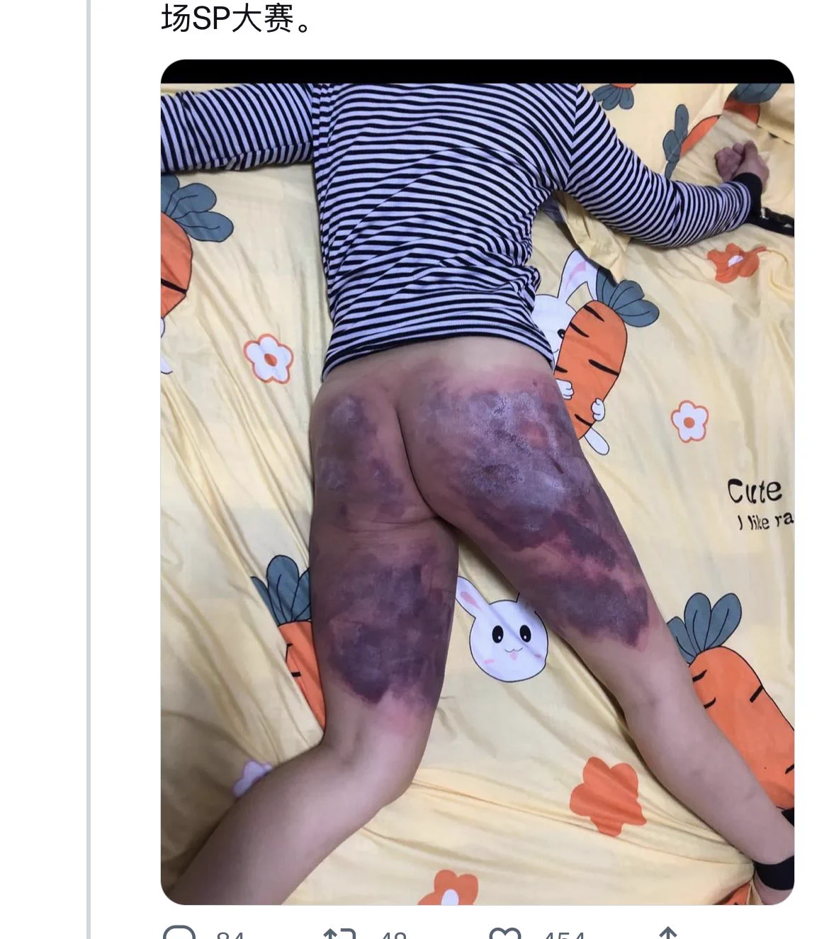 首页刷到的，真无语了，sp不是那么搞的啊，大腿根和大腿只能些许抽打，不能打太多，就算m喜欢重度你也不能真下狠手抽大腿好吧，真的啥几把人都能自称s🙃🙃🙃 https://t.co/blHvjmbpRS