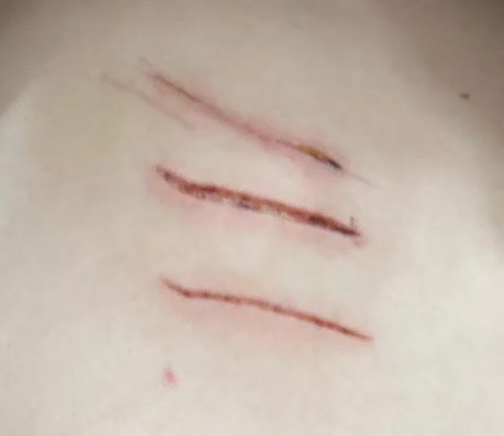 为什么要生这种病啊虽然我平时就发小黄图小黄文不太说话但是我好痛苦 https://t.co/YzxezhzKs9