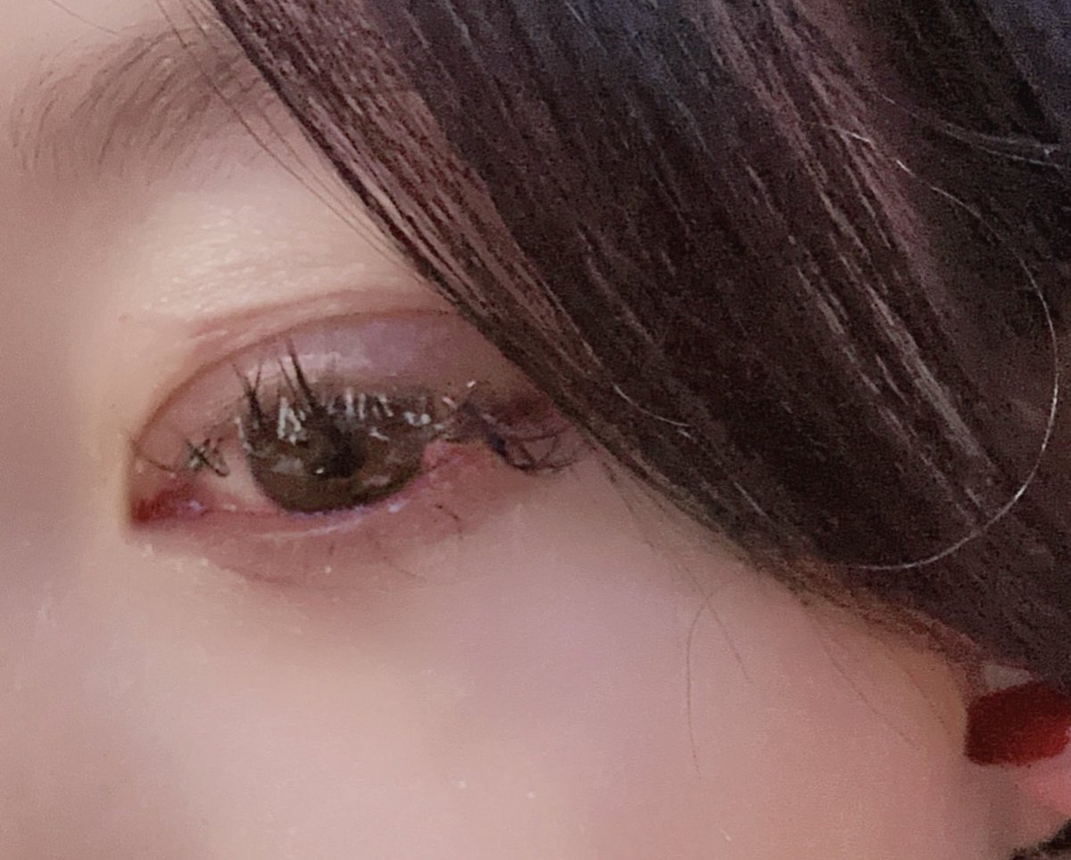 熬夜不可取这是我前天熬夜到4点的后果！
早睡早起贝贝们，对身体好 https://t.co/oAxGwYAA65