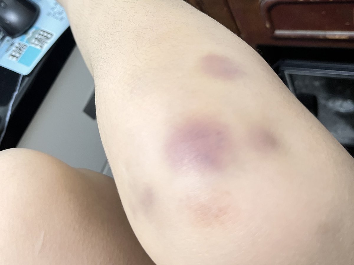 從小時候就拍貓 怕到現在從樓梯上掉下來 https://t.co/qlLoz5DuUM