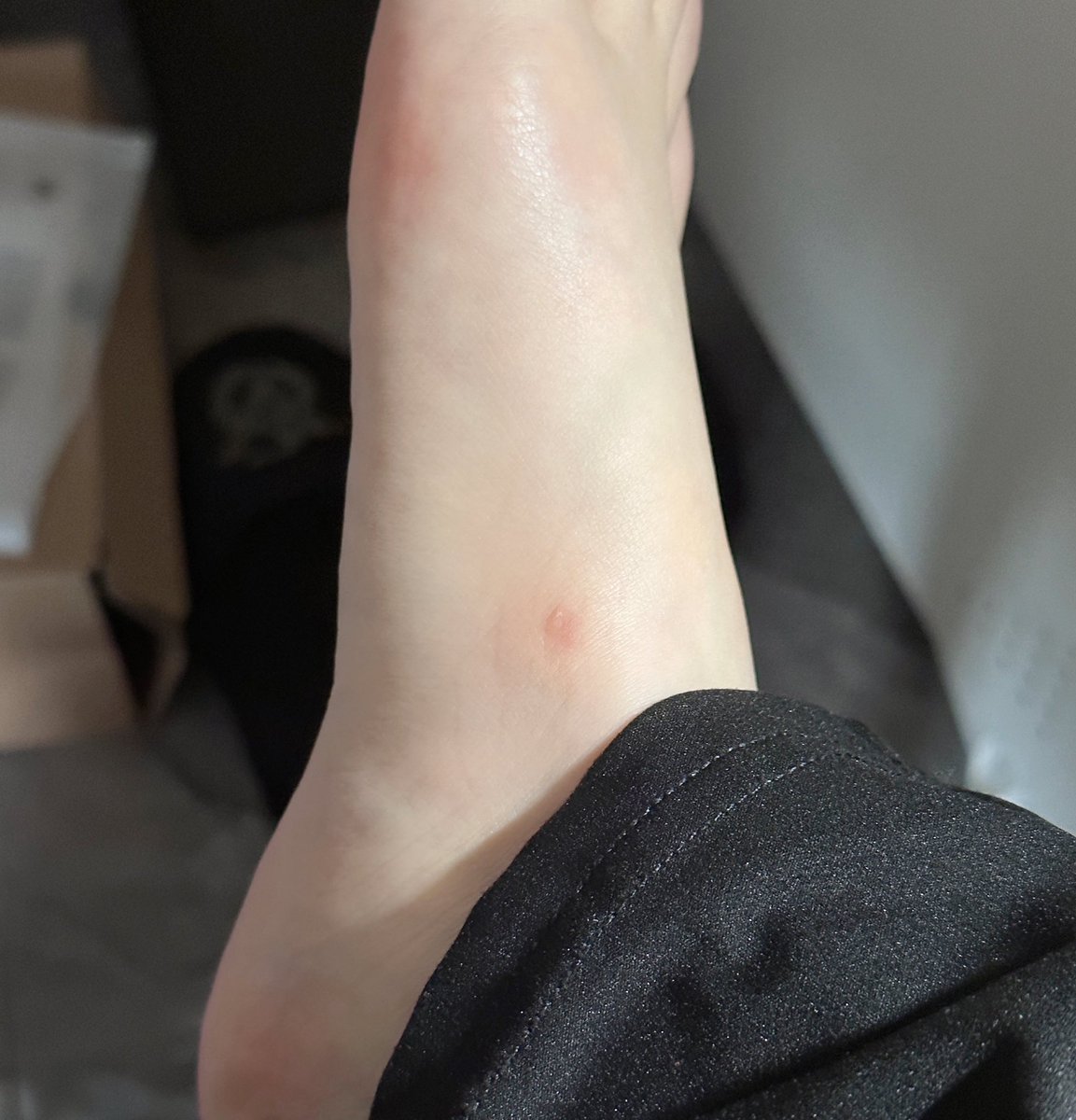 大胆厨师鞋 送我一个水泡 https://t.co/SKmyIG99kC