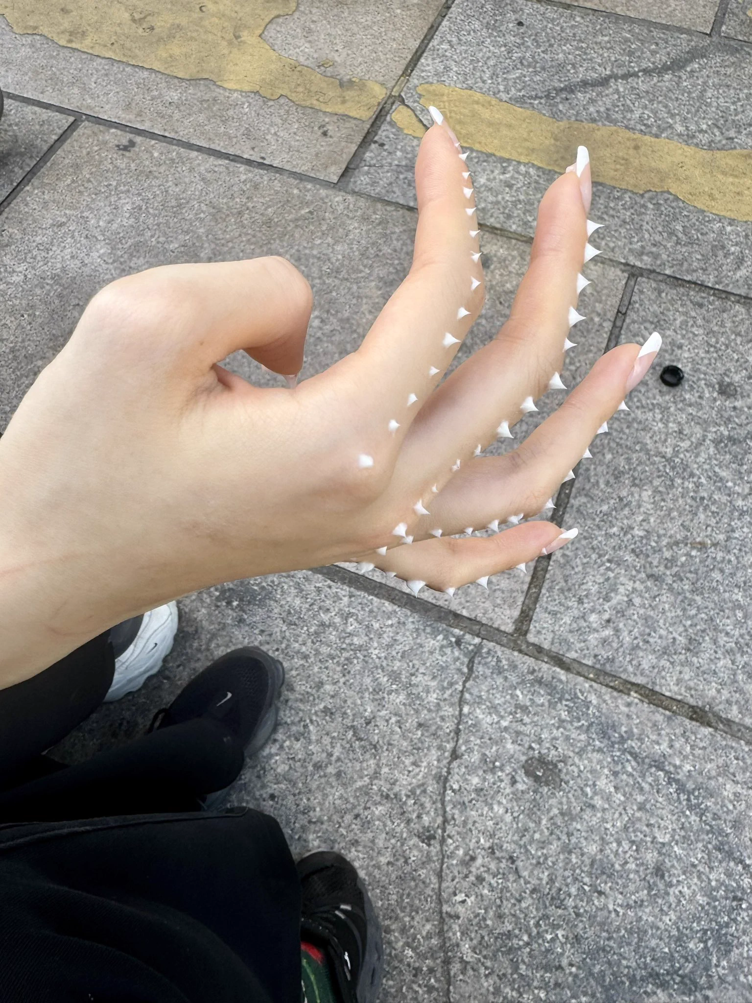 某人手部尖锐湿疣哈哈哈哈哈 https://t.co/PLPDhnkxeR