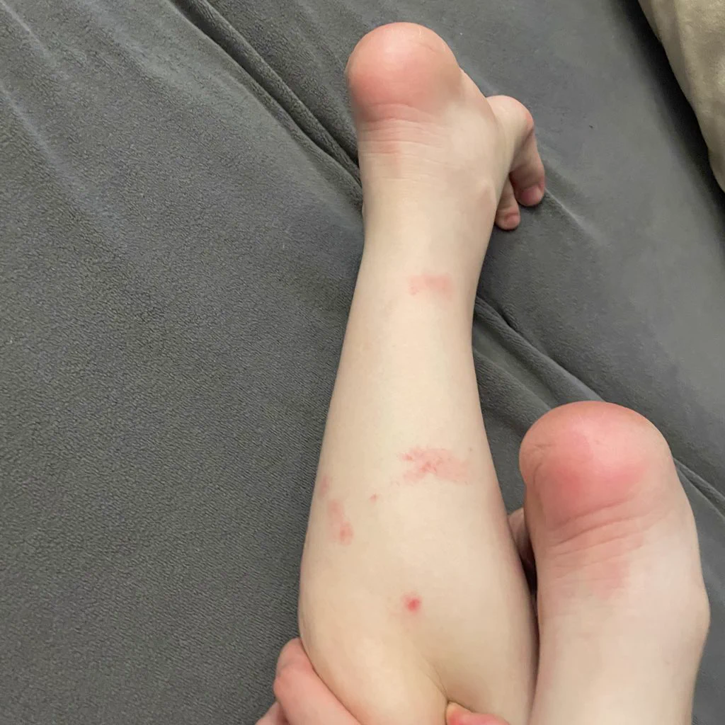死蚊子，你欠我的拿什么还😭😭😭😭😭😭😭 https://t.co/Yx3BYD0Pre