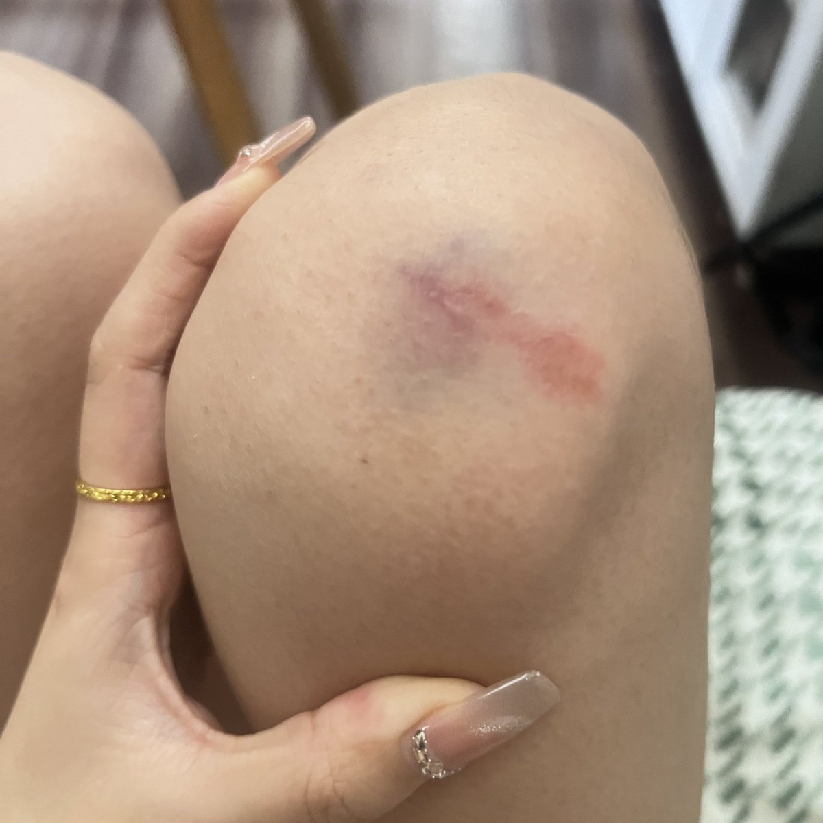 再也不喝了 https://t.co/ywChYREsVn