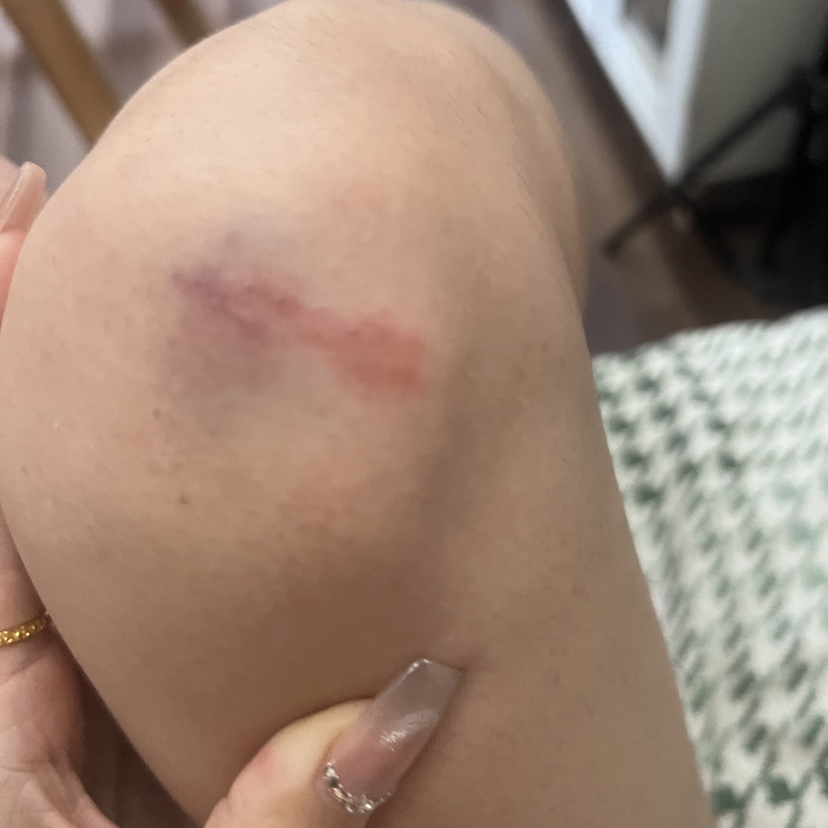 再也不喝了 https://t.co/ywChYREsVn