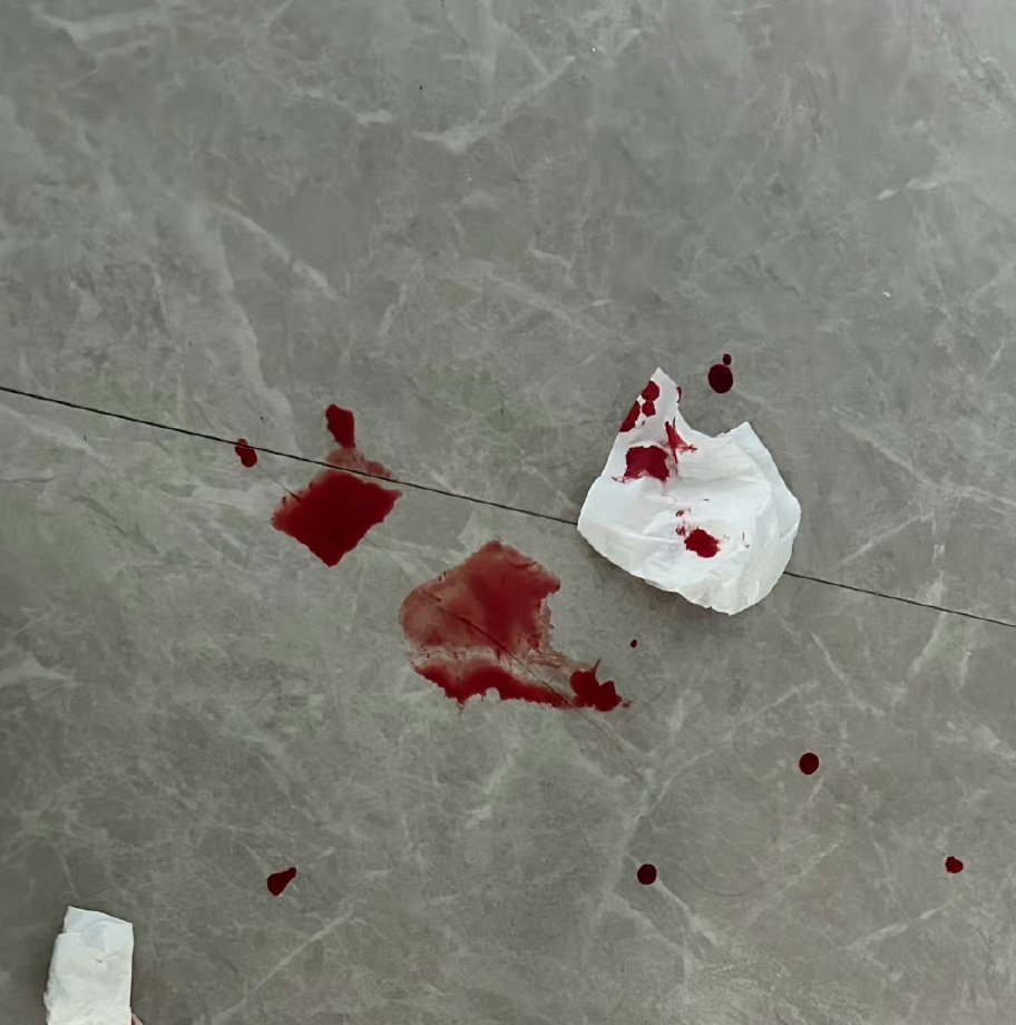 昨晚的惨状…… https://t.co/PcH6s3WWcz