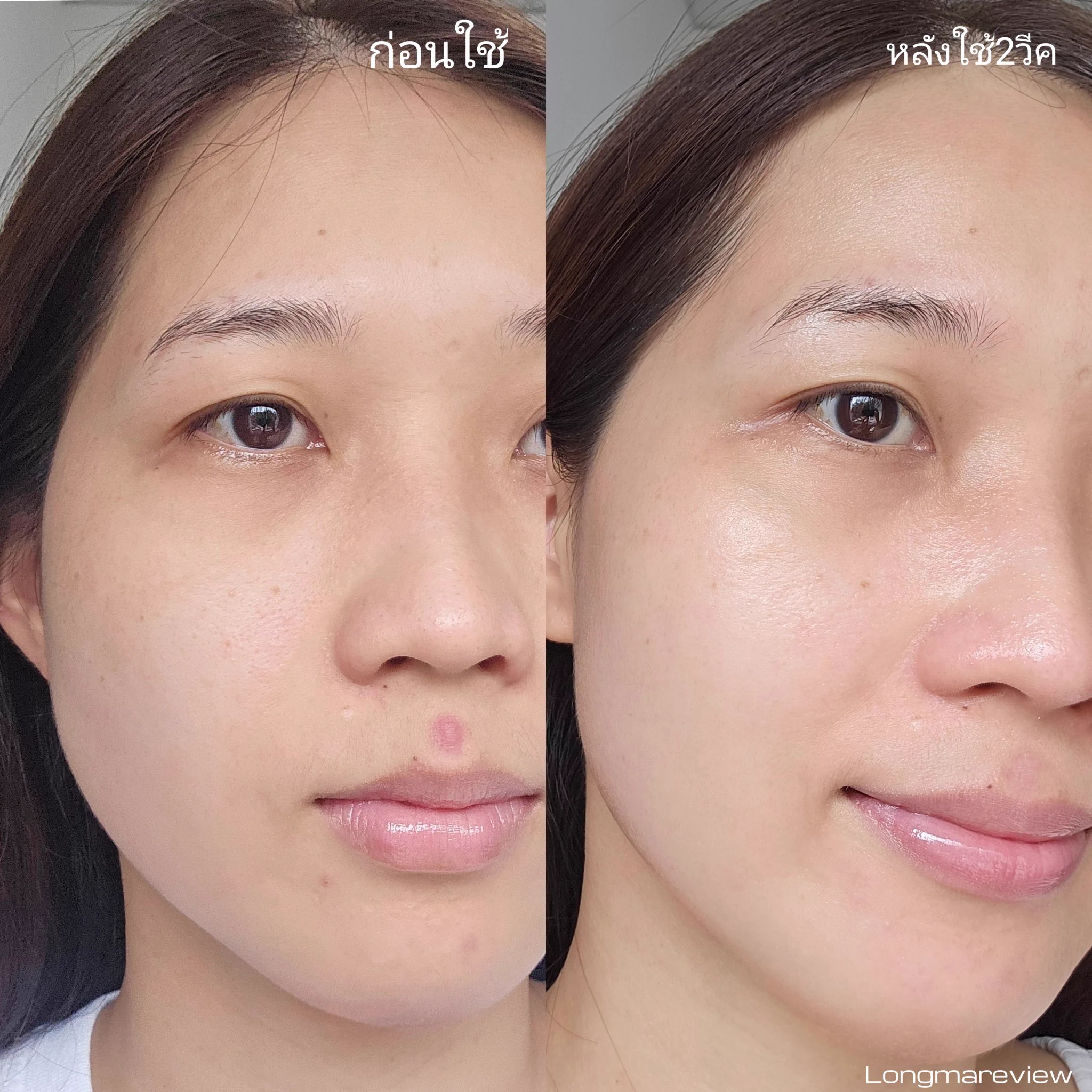 ดาร์กสปอตของ​axis-y ช่วยเรื่องรอยดำดี​อ่าาา​ สิวตรงปากวนกลับมาอีก​ ทิ้งรอยชัดมากก​ ใช้ตัวนี้มาสองวีค​ ทาเช้าเย็น รอยดำค่อยๆจางลง​ ปรับผิวเสมอกัน​ ละผิวเพิ่มชุ่มชื้น​ขึ้นด้วย​ ชอบมากก​ ใครผิวเป็นสิวแพ้ง่ายแนะนำเลยๆๆๆ​ #ใช้ดีบอกต่อ https://t.co/Mc5cgZAjw4