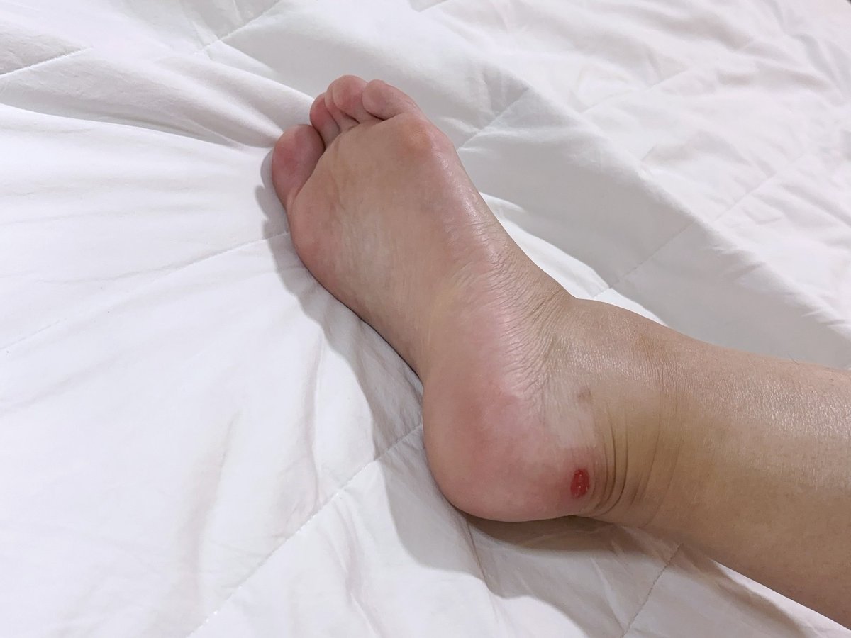 週末只剩今天可以出去玩了ㄟ🥹
但我的腳腳破皮還沒好不能穿高跟鞋
哭哭 https://t.co/BAPLWnDfVW