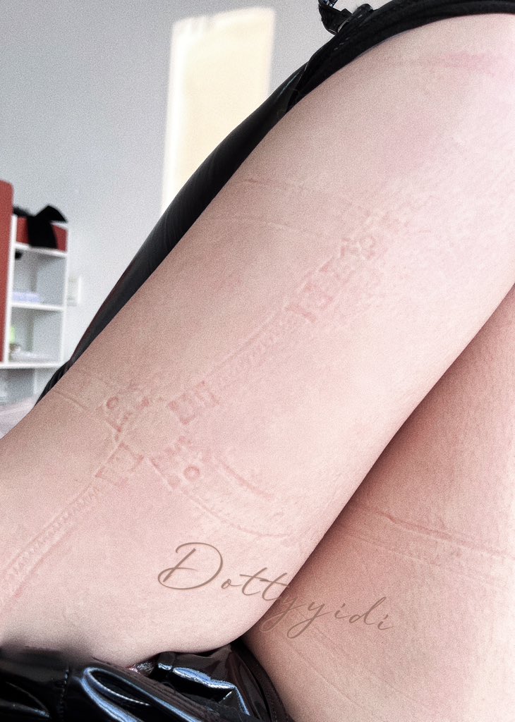 印记永远会消除，疤痕才会永久保留 https://t.co/XYUoTFDKea