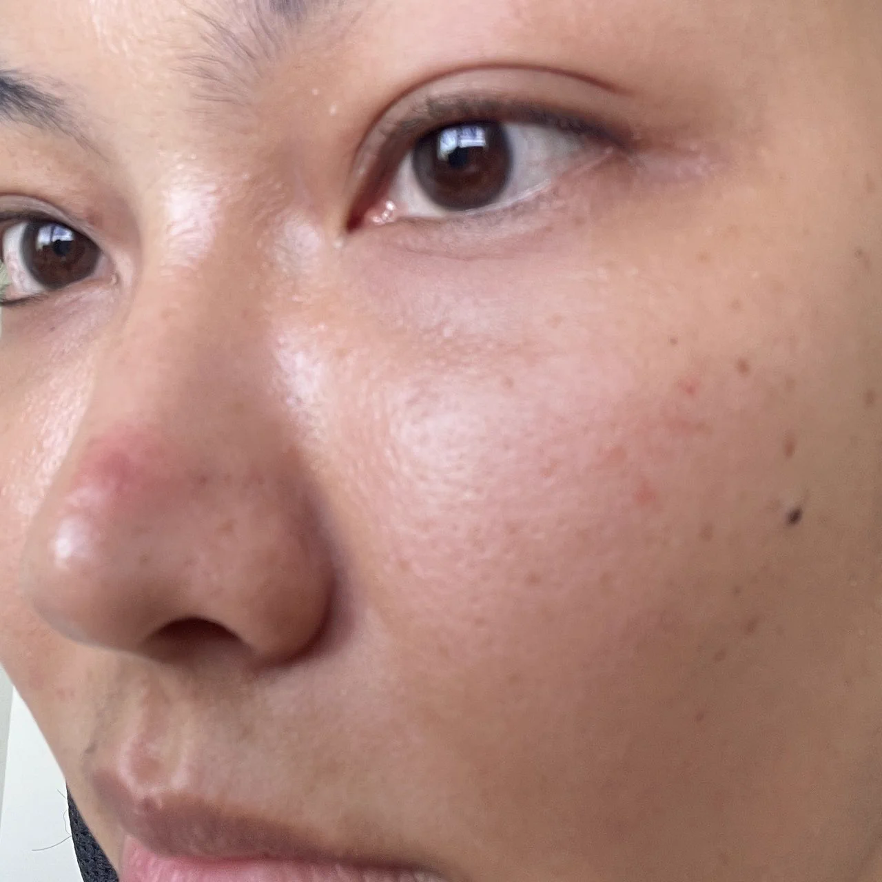 La Roche-Posay ไม่มาเล่นๆฮะ ก่อนออกงานที่ต้องใช้หน้าคือคุณสิวจะมารู้เวลาตลอด บิวได้ Effaclar Duo+M สูตรใหม่มาลองพอดี ใช้ก่อนนอน 8 ชั่วโมง ตื่นมาสิวก็เริ่มแห้งละฮับ คือเค้ารีเสิร์ชมาแล้วว่าการเสียสมดุลของแบคทีเรีย C.Acnes( 1A1) ซึ่งเป็นตัวก่อให้เกิดสิว ตัวนี้มี Phylobioma ช่วยจัดเรื่องสิว ปรับสมดุลแบคทีเรียบนผิว ลดความมันส่วนเกิน เนื้อสัมผัสดี ซึมไว ใช้แล้วสิวดูจางลง ผิวเรียบเนียนขึ้น สูตรนี้รอยแดงยุบไวกว่าสูตรเดิมด้วย แนะนำงับ หาซื้อได้ตาม WATSONS, BOOTS, EVEANDBOY, BEAUTRIUM, LAZADA, SHOPEE, KONVY, CENTRAL ONLINE เลยค่ะ#LaRochePosayTH
