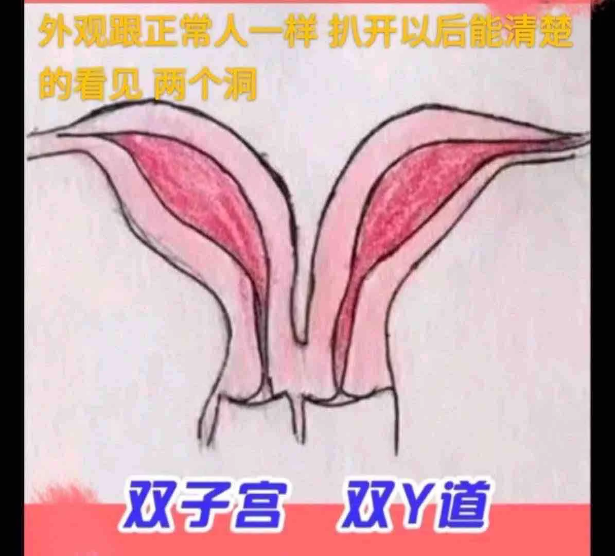 上海罕见双阴双洞.年龄：05.身高：168.体重：85.Bust胸围：C可无套 可三通 可液体🉑69🉑kiss三点粉 皮肤雪白 不催不事儿双阴介绍：双子宫双阴道的发生概率1/1000000，欢迎品鉴#花无缺精选俱乐部 推特最全面覆盖的外围经济咨询客服:https://t.co/TOw8c1Rny0电报群:https://t.co/2HTKjwlTmn https://t.co/CaYJ8eVtDv