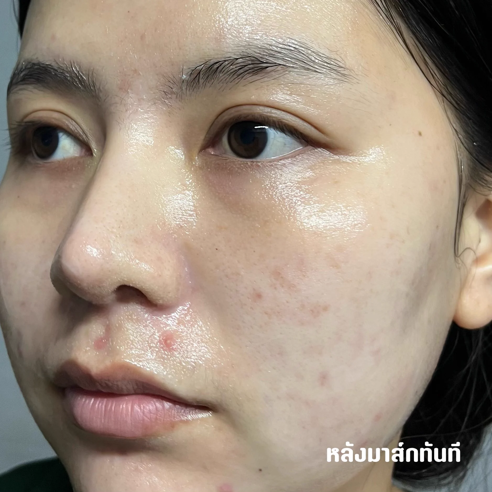 ช่วงนี้อินกับการมาส์กหน้ามากกก ชอบมาส์กของวัตสันสุด เพราะเค้าพัฒนาร่วมกับแพทย์ผิวหนังประเทศเกาหลี แถมราคาดี ตุนได้ตุนตลอด สูตรที่ชอบสุดจะเป็น CICARE กับ Essence Mask วันไหนอยากรู้สึกว่าผิวอ่อนแอเราจะใช้ cica เพราะความอ่อนโยน ช่วยปลอบประโลมผิว ช่วยเสริมเกราะป้องกันผิว วันไหนอยากเสริมความใส ก็จะหยิบ Essence Mask มาใช้ หลังใช้คือรู้สึกได้เลยว่าหน้าดูใสขึ้น อยากให้ทุกคนได้ลอง #รีวิววัตสัน #WatsonsKMaskExpert #watsonsth