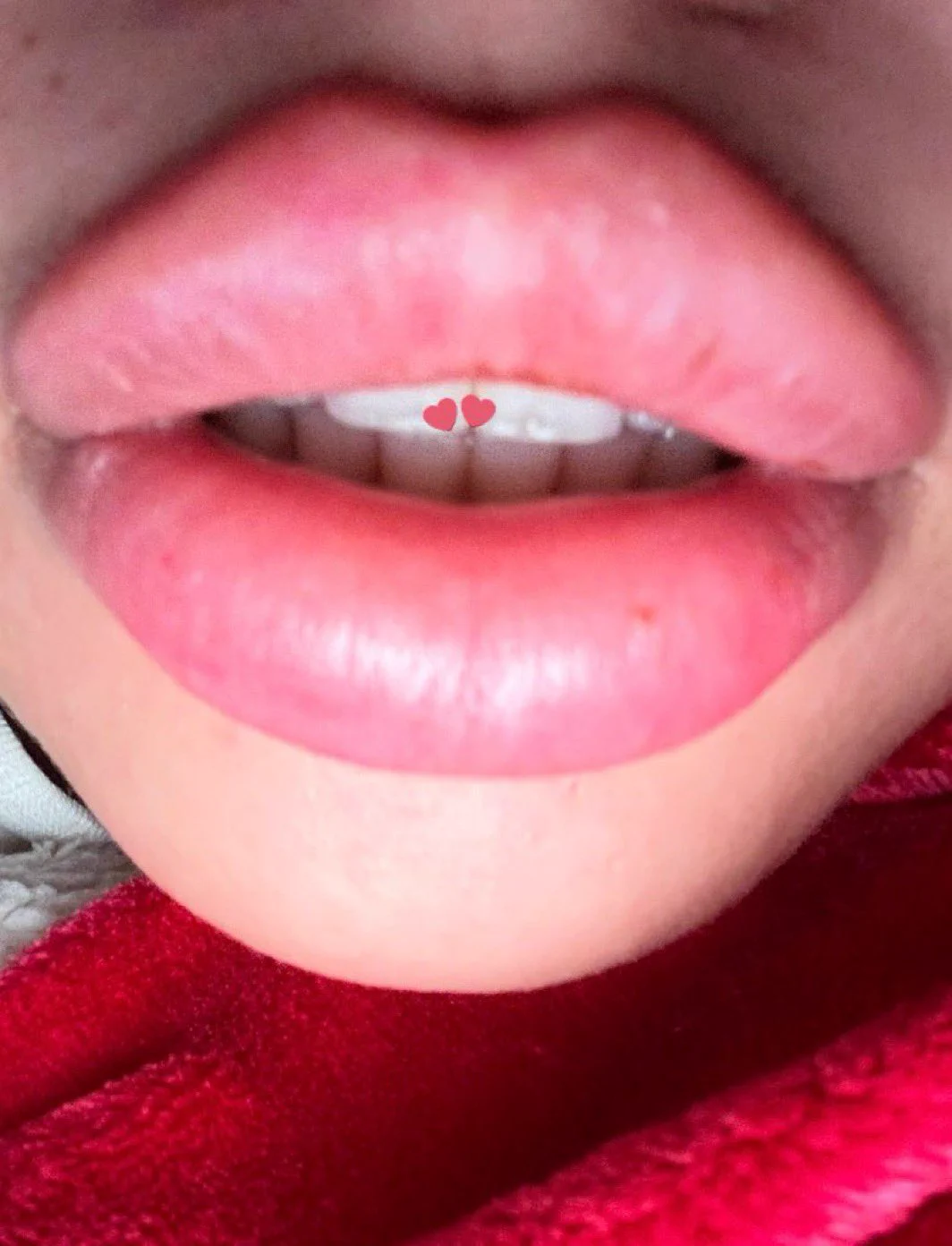 rate my lips 1-10 for a dm 🫦 https://t.co/FQ0h4L9dK0