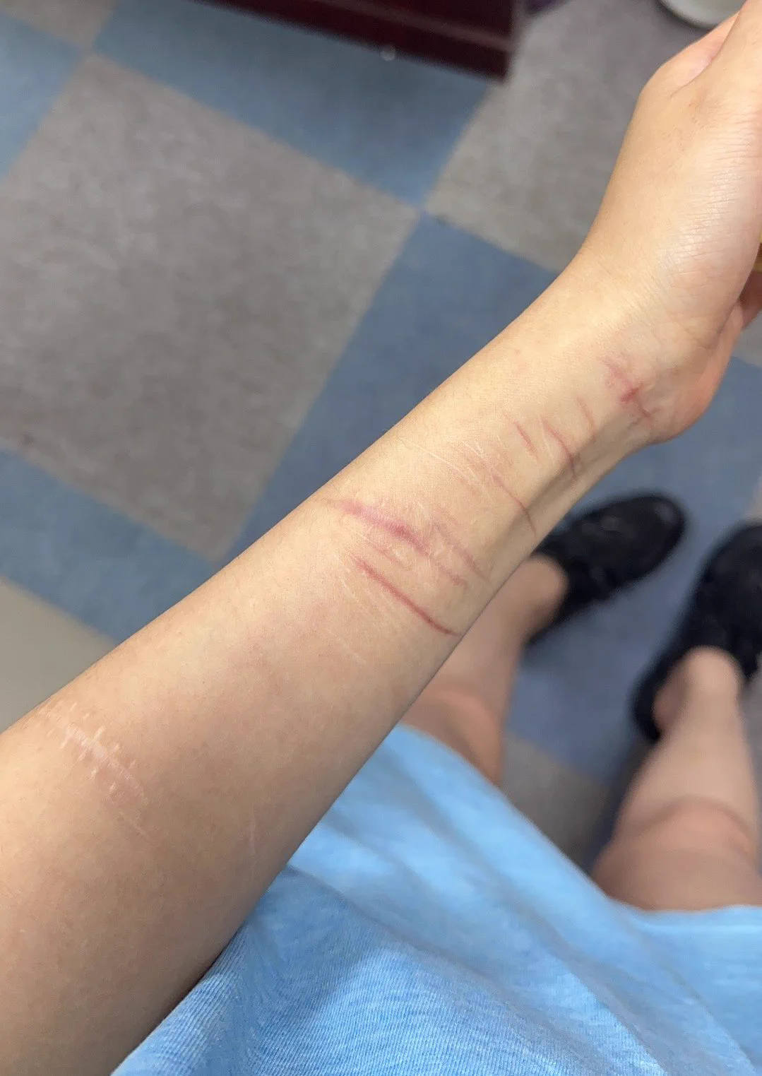发出来确实也是没办法了，我还是在向外求认同，一直没有说吧。14岁吧从父母离异的时候，其实根本不在乎她们离婚，只想求我妈要我，她别不要我，那时候轻微的划几刀让家人重视我开始，可能已经开始生病，确实没换来什么，还是被抛弃到大姑家，寄人篱下每天怎么想着能讨好大姑给我点好脸色，只能帮着骗我爸钱给大姑点生活费，我被家里亲戚搞的无法上学，去上了职业技校，没想到15岁还是被强奸，不是那种真的变态拉到小树林那种，同学拉到量贩式唱歌，然后被所谓他大哥强奸，事后还因为我没有流血，说我不是处女，然后我换上了斯德哥尔摩综合症，我没多久被搞大了肚子，是的，他家是个收废品的，我记得是安徽的，他妈妈说要不然娶了我，他嫌弃我太胖（导致我现在无论如何都不会让自己胖上去）我被这样打了胎，我第三天流产让他在我家又给一顿啪啪啪，我可能就是这样很小打胎没有恢复好就后面造就了不孕不育，这么多年只要一上火或者一免疫力下降我就会犯盆腔炎，后来家里人发现他说不认识我，我跪着求家里人不要告他强奸，就这样我被家里人关了半年去了俄罗斯留学，到那姐姐设计陷害我，爸爸怀疑我不是亲生…省略一万字吧，某年某月。我遇到一面墙。我一头撞了过去。人没死。青春替我抵了命。后来又遇到一面墙。墙说它很软。不会撞疼我。我义无反顾的撞了过去。结果人是没死。心没了...到现在也没有青春了，其实已经30多岁了，反正划了上百刀吧，缝了里外三层那种也有4.50针吧，有的肉多的就看到脂肪，手腕的就快碰到肌腱吧，我其实脾气一直都不好，我选择伤害自己不是真的想死，我觉得这样能释放出来吧，能得到想被认可的人关注吧！我确诊开始吃精神分裂药是在2022年1月份吧，后来23年我退圈那一年各种抑郁症临床，中间发生的事我也不知道你们想不想听，说这么多其实我也想救现在的自己吧，遭受各种，离异，当三，用力爱，自己也出轨，骨折，各种治病，玄学出马，失恋，唯独没有学会爱自己吧，为了救自己艾灸上的腿上全是疤，被你们造谣说我是吸毒，得x病了，瑜伽是真的能找到个适合自己的运动吧，之前我从不想解释这些，愿意暴露给你们看身体，甚至在你们面前疯狂自慰，各种风油精，我享受疼痛带来的内啡肽，我一个缺爱到扭曲的人，会疯狂给正常人献爱，就像穷光蛋再给亿万富翁捐款.人我现在变得很麻木。就像当年吃阿立哌唑一样，只是那时候是无欲无求，现在是情感很迟钝，躯体化，被害妄想越来越严重，关键我现在只是没有感知幸福的能力了。我不知道什么是想要的生活！不祈求认同，可怜之人必有可恨之处！不过是用自己的绝望毁掉自己。这就是“不想好了”四个字的由来，真的是那一刻不想好了。