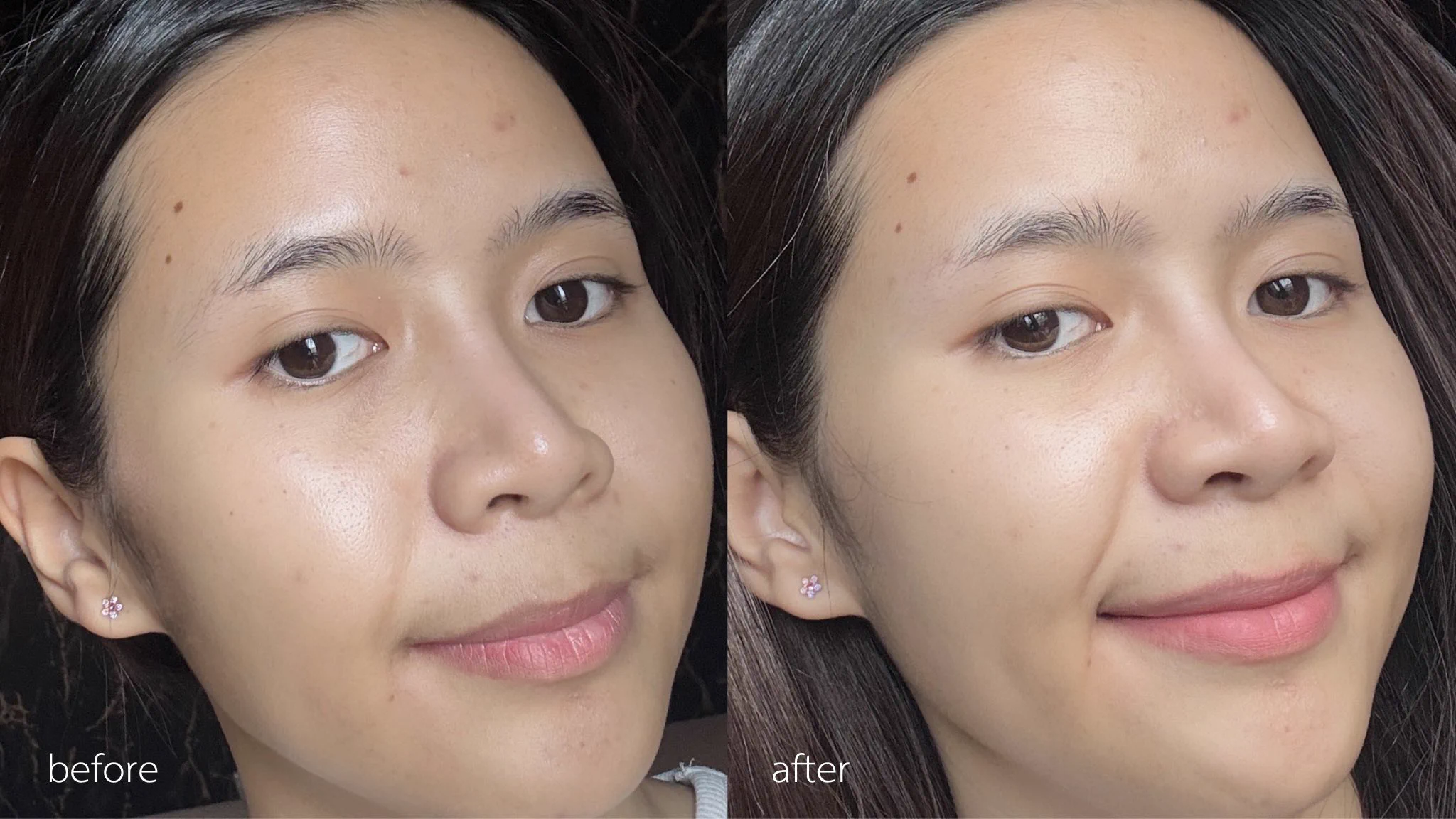 ป้ายยาคู่นี้ไปหลายคนละ บับมันจึ้งเกิน ลาโรชคือที่ 1 ในใจเรื่องสิว ใช้ตั้งแต่เริ่มมีสิวแรกๆ ล่าสุดลองใช้คู่กับเอฟฟาคลาร์เซรั่ม แล้วรู้สึกเห็นผลดีกว่าใช้ตัวเดียวเดี่ยวๆ สิวขึ้นน้อยลง สิวอุดตันคือหลุดออกมาเปงงเม็ด นี่ว่าช่วยเรื่องสิวอักเสบด้วย ของแถมที่ได้เพิ่มคือหน้าใสขึ้นอีก รอยสิวก็จางลง #LaRochePosayTH #Effaclar #ลาโรชโพเซย์ #เอฟฟาคลาร์ #เอฟฟาคลาร์ดูโอพลัสเอ็ม