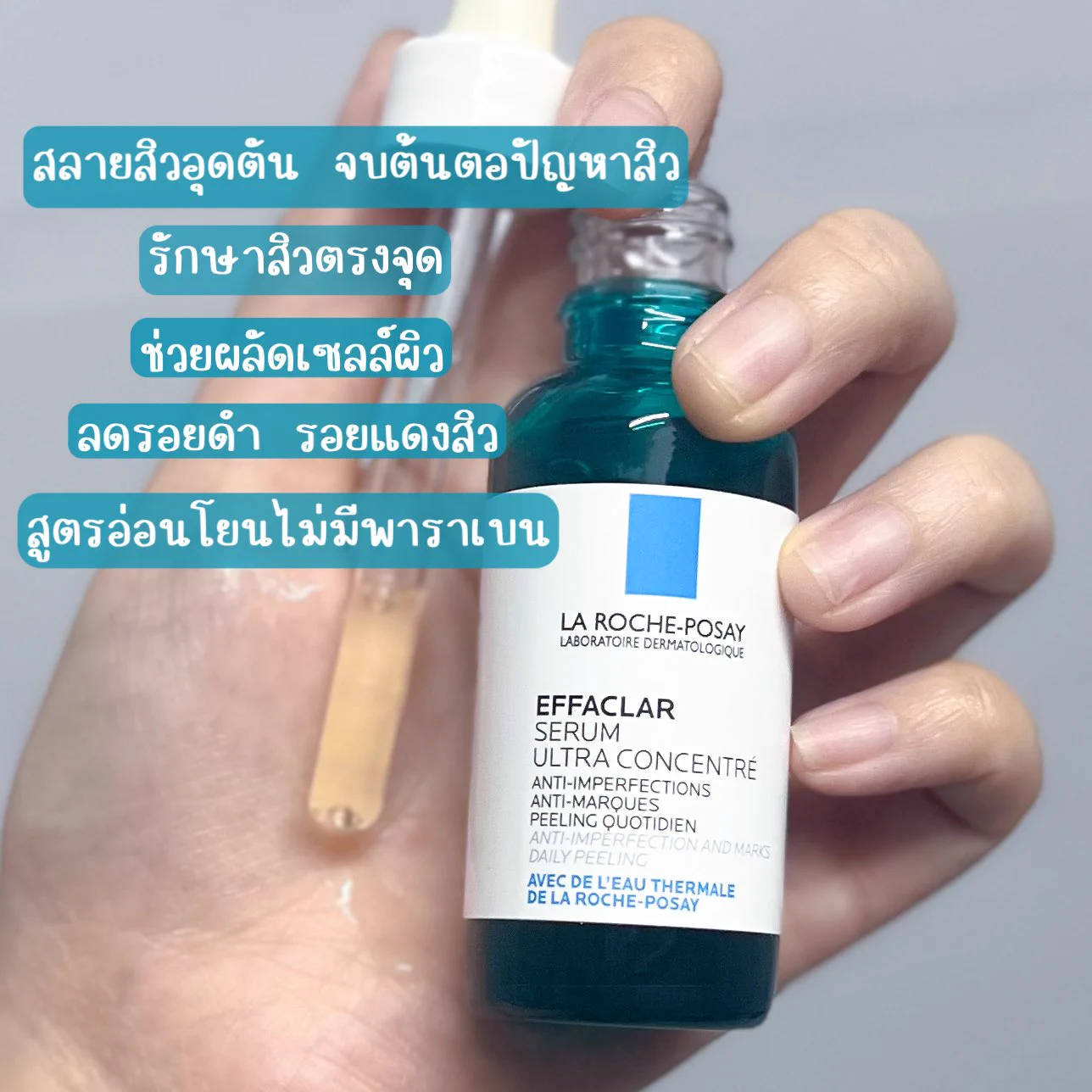 เห็นผิวเนียนๆ อย่าพึ่งวางใจ อาจจะมีสิวอุดตันรอประทุ ตอนนี้เรากำลังเจอปัญหานี้เลย เห็นผิวเริ่มเนียน เลยเลิกใช้กลุ่มรักษาสิว สรุปสิวอุดตันประทุจ้า เลยได้ถอยเซรั่มลาโรชมาใช้ ช่วยผลัดเซลล์ผิว จัดการสิวอุดตัน จบต้นตอปัญหาสิว รอยดำรอยแดงก็ลดลง ทีนี้ก็หน้าเนียนแบบสบายใจ 🫶🏻✨🩵https://t.co/G60Udn36Rk 🩵https://t.co/i54rRpBHEW #LaRochePosayTH #Effaclar #ลาโรชโพเซย์ #เอฟฟาคลาร์ #สลายสิว #เอฟฟาคลาร์เซรั่ม #EffaclarSerum #รอยสิว #สิวอุดตัน