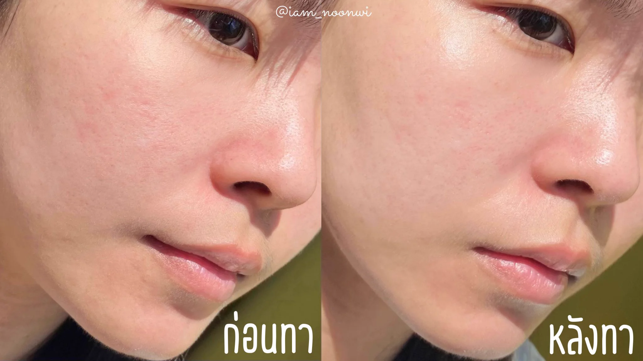 กันแดดเนื้อเซรั่ม #Skintific ~☀️ เนื้อกันแดดดีมากกก บางเบา ซึมง่าย สบายผิว ฟินิชผิวโกลว์นิดๆ มี Niacinamide ช่วยให้ผิวกระจ่างใส+สีผิวสม่ำเสมอ SPF50 PA++++ จะเซตแค่แป้งหรือแต่งหน้าต่อก็เอาอยู่ เพราะน้องไม่รบกวนเมคอัพ ใช้ได้ทุกวันเลย ดีจริง ชอบมากกก🥹 #ใช้ดีบอกต่อ https://t.co/Fy7TkUhNNH