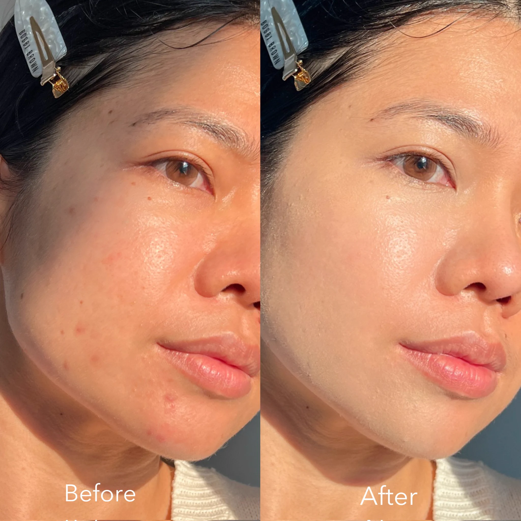 ลองยัง ถ้ายังไปลองง Skintific ออกคอลซีลเลอร์ ดีมากกก แบบมั๊กกก เรื่องเนื้อให้ยืนหนึ่งของความเกลี่ยง่าย ไม่เหนียวเลยย ออกแบบมา 2 หัวตรงนี้คือ ปังง บอกลาใต้ตาหมีแพนด้า กับจุดด่างดำไปเลยย ใครไม่ชอบแต่งหน้า แค่แท่งนี้จบบบบ #Skintific #SkintificTH #SKINTIFICConcealer https://t.co/rYthffEkrt