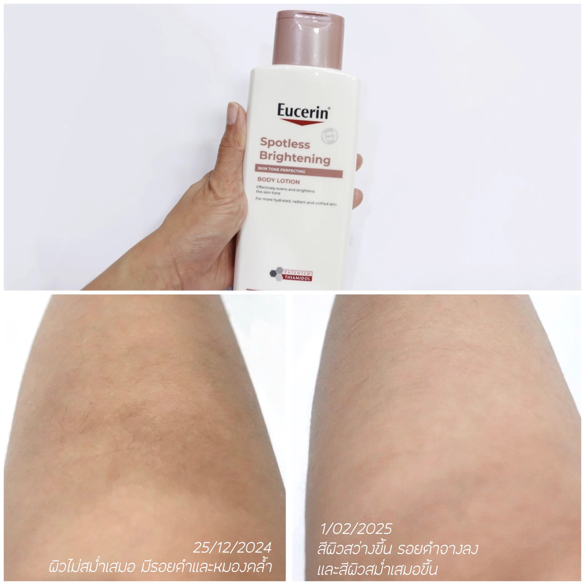 บอกต่อ โลชั่น ที่ใช้อยู่ช่วงนี้ แล้วผิวสว่างขึ้นจริง Spotless Body Lotion ตัวนี้เลย เค้ามีสารไทอามิดอล สารไบรท์เทนนิ่งตัวดังที่ช่วยยับยั้งรอยดำที่ต้นตอ เราใช้มาตอนนี้ได้ 1 เดือน จากผิวที่ดูหมองคล้ำ มีรอยดำกร้าน ตรงหน้าขา  ดูสว่างสม่ำเสมอ สีผิวเท่ากันแล้ว ผิวยังชุ่มชื่นขึ้นด้วย ทาแล้วซึมไวไม่เหนอะหนะ  เราเอามาทาก้นด้วย ตอนนี้รู้สึกก้นใสขึ้นมาอีก ชอบ มาก แนะนำเลย #ดีต่อใจ #EucerinThailand #โลชั่นผิวขาว #ไทอามิดอลบอดี้โลชั่น