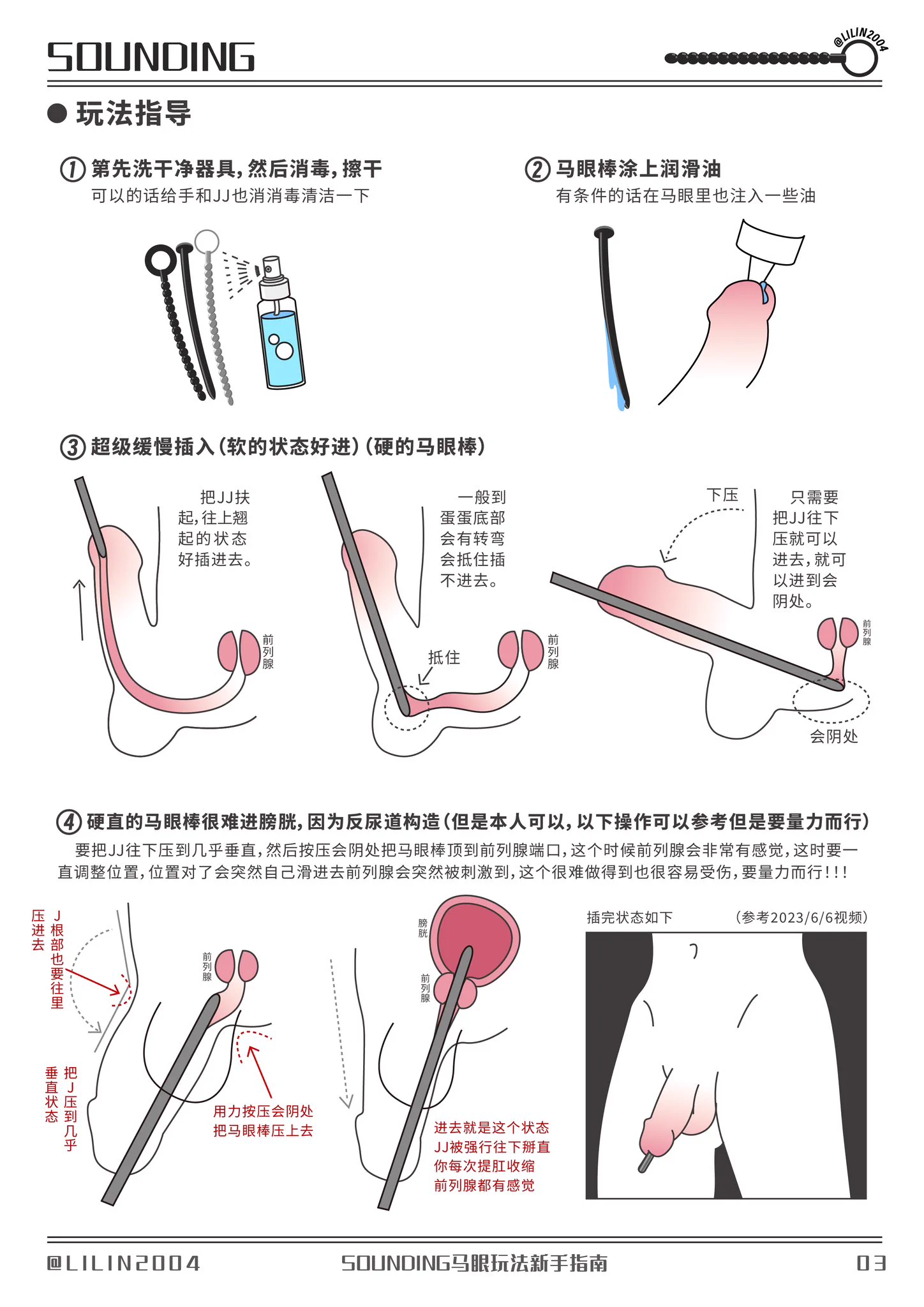 一堆人问我有关马眼棒的问题，直接出个指南自己参考 #sounding https://t.co/9BDfYcV2na