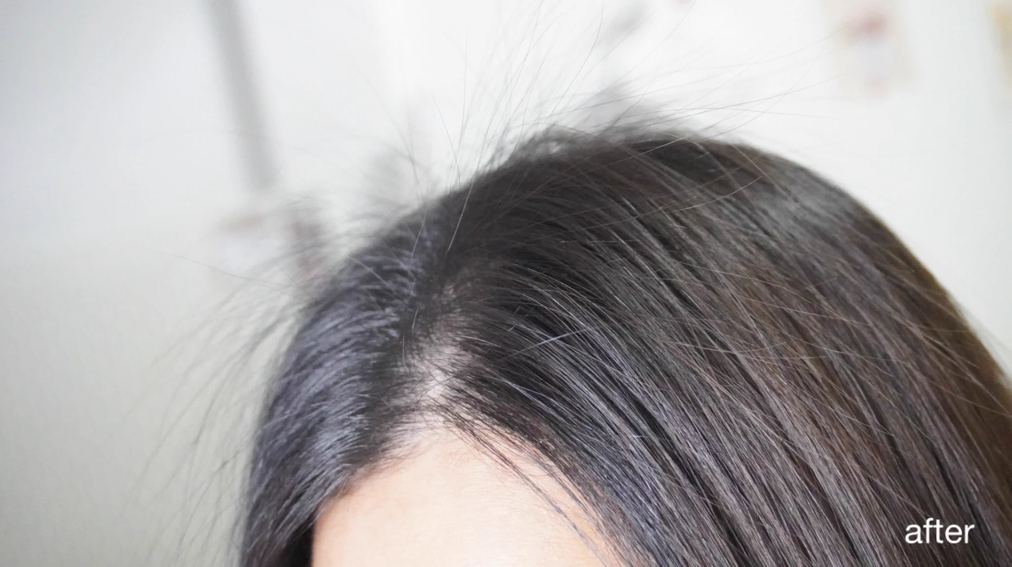 ต้องแมสแล้วนะ~ เริ่ดจริงงง! ชาวผมร่วง มามุง Anti Hair Loss Treatment เซรั่มบำรุงหนังศีรษะ หยดหลังสระผม แล้วนวด ๆ นะ ค่ดผ่อนคลาย ใช้แล้วผมร่วงน้อยลงมาก เลิศ https://t.co/DupMNA0hNK