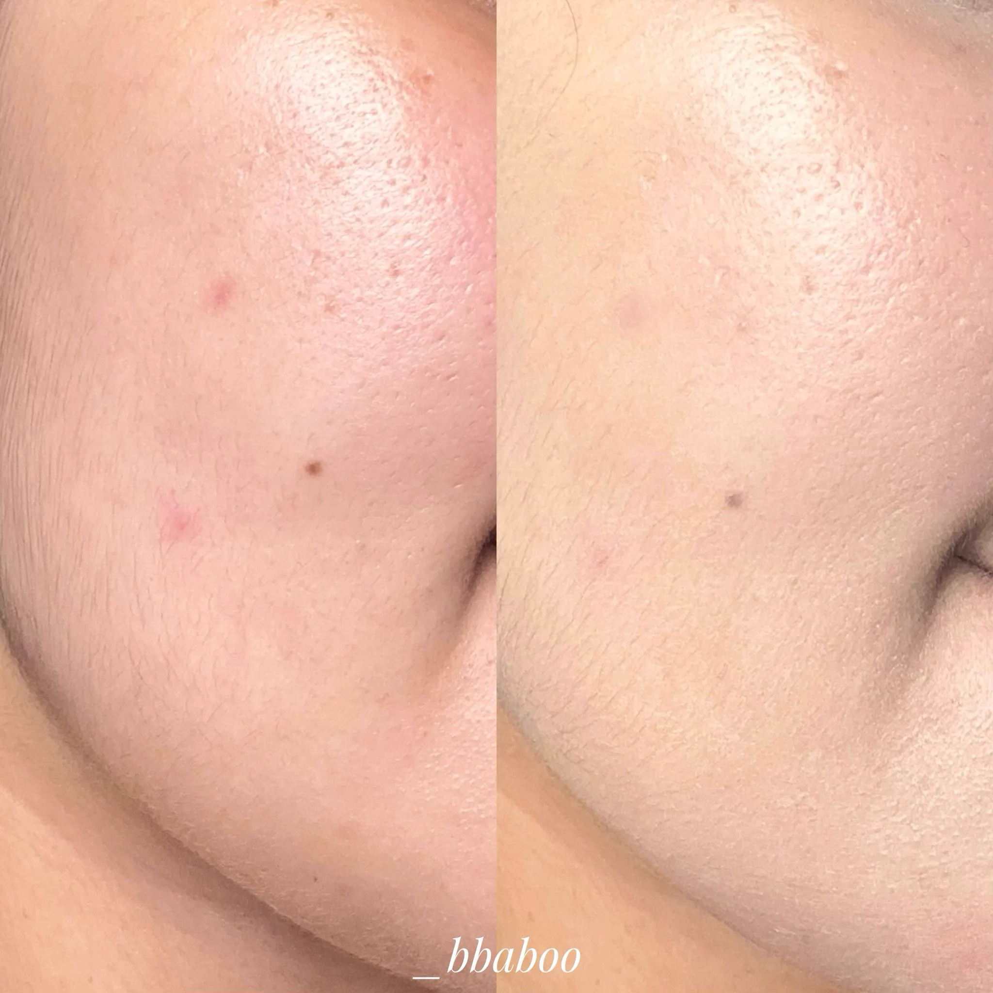 คอนซีลเลอร์ Dual tip 2 หัว ของ #skintific ปกปิดดีอยู่น้าาาา มี 2หัวเป็นแปรงคอนซีลเลอร์กับหัว correct ใช้ง่ายมากกก เราใช้ 01N1 สีพอดีเลย✨ https://t.co/iUczVQfrYN