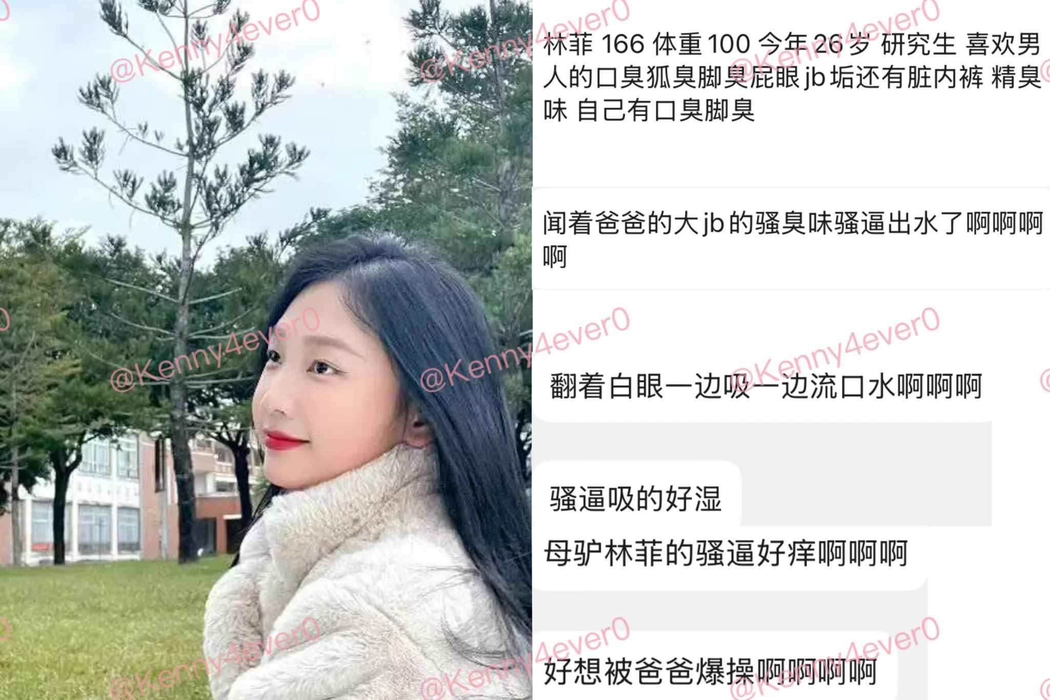 平时人模人样被人捧在手里的 到了亲爹胯下变成了无脑鸡巴套子 婊子不就是用来狠狠发泄的么 #反差 #人妻 #聊骚 #露出 #女大学生 #母畜 #羞辱 #婊子 #骚货 #女高 #女大 #真空 #社死 #母狗 #肉便器 #鸡吧套子 #母畜 #羞辱 #眼镜婊 #母畜 #骚货 #肉便器 #洗脑 #母猪 #母驴 #反差婊 #强迫 #胁迫 #bbc #黑爹 #媚黑 #easygirl转推感谢💌: @Kennnyyy0 @007share @tbzt2024 @DDDDBBHHH @wqganenshi_