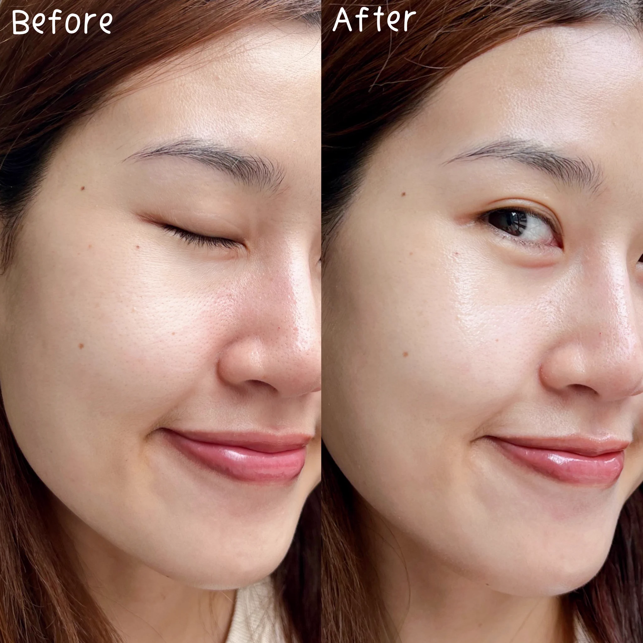 สกินแคร์บำรุงผิวหลังสงกรานต์ ต้องคู่นี้แหละ Glad2Glow bright set กู้ผิวหมองคล้ำจากแดด ดีมาก เซรั่มเนื้อบางเบา 10% Niacinamide ช่วยให้ผิวใสสม่ำเสมอ จุดดำจางลง และครีมมอยส์ 5% Niacinamide ผิวฉ่ำ อิ่มน้ำ ดูสุขภาพดีสุดๆ ใช้คู่นี้ต่อเนื่องผิวยิ่งโกลว์ใสขึ้น ของถูกและดีมีอยู่จริง 💞 https://t.co/FxhdkxlPpX
