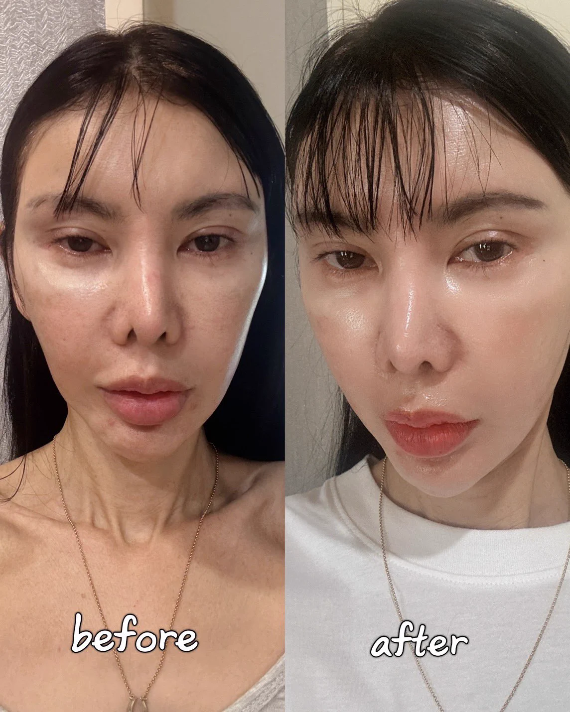 เมื่อก่อนร่องแก้มดูไม่จืด อาศัยเลเซอร์ยกกระชับช่วย ไม่อยากหน้าแก่กว่าวัย🥲 แล้วยิ่งมาใช้คู่กับ Eucerin Epicelline® Serum ร่องแก้มตื้นขึ้นแบบเห็นชัด แล้วตัวนี้ทาง Eucerin เค้าทำการวิจัยจริงจังเรื่อง Epigenetics ที่ส่งผลต่อการเกิดปัญหาผิวแก่ถึง 15 ปี!! (นานมาก) เลยเป็นเซรั่มที่เก่งมากที่ช่วยที่จัดการ 10 สัญญาณแห่งวัยระดับเซลล์ผิวได้ นี่ใช้มาเดือนนึง บอกเลยน้องลดริ้วรอยโคตรเก่ง ผิวแน่นเฟิร์มขึ้นจริง💪🏻