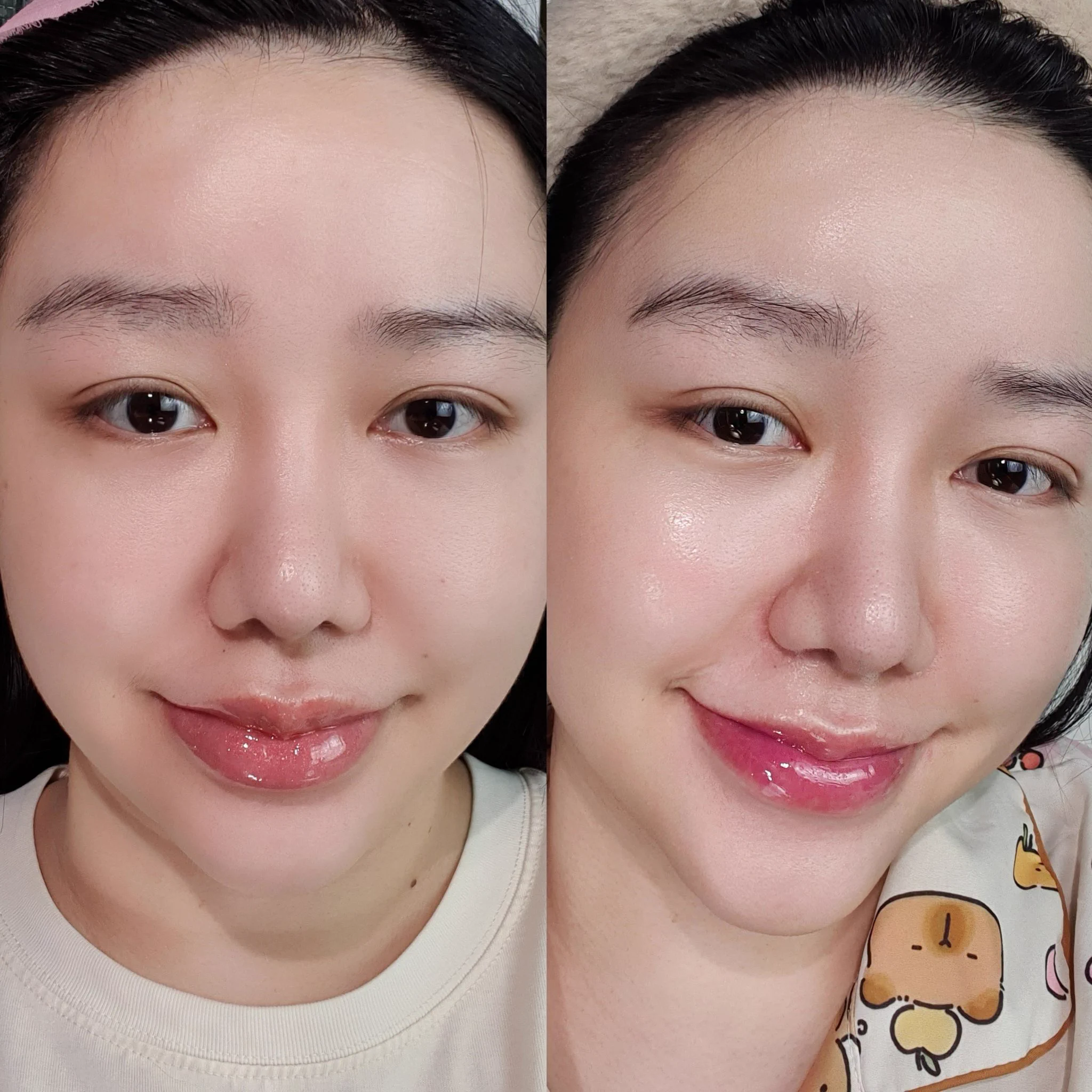 Eucerin คือเกิดมาเพื่อชั้นเว่อ ถูกกับผิวไปหมด ใช้อะไรก็ดี ล่าสุดลองเซรั่ม EPICELLINE® เซรั่มลดริ้วรอยตัวดังของปีนี้เลย อมก มาก ผิวละเอียด โกลว์สวย อิ่มฟูสุดๆ หน้างี้เด้งนุ่มสู้มือมากด้วย ฟินนนน ช่วยลดเลือนริ้วรอยให้ผิวอ่อนเยาว์ ใครชอบทำหัตถการให้ผิวดูเด็กตลอด แนะนำใช้ตัวนี้ควบคู่ไปด้วยคือเริ่ดมาก