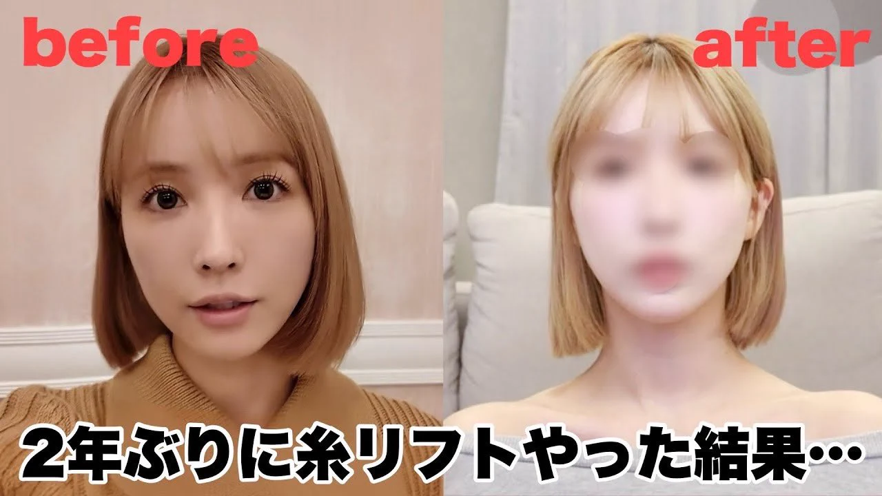🤍モニターさん募集🤍私がアンバサダーを務めるAクリニックで1day小顔のモニターを受けてくださる方を募集してます🫶🏻ご応募が本日までです🩷私もやっている小顔施術、ぜひ体験してみてください👶🏻▼応募はこちらhttps://t.co/NbeoYM9Eka https://t.co/yuvb9FlgAy