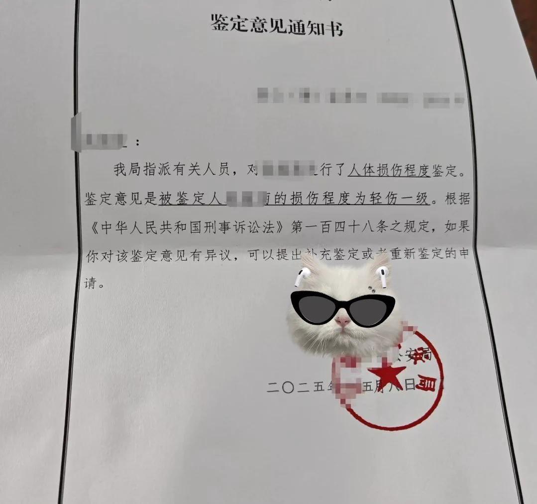 报警后续：今天的鉴定意见通知书，我被鉴定为轻伤一级，那个人要完蛋了2025年5月8日，记住这个日子 https://t.co/G06p2puprc