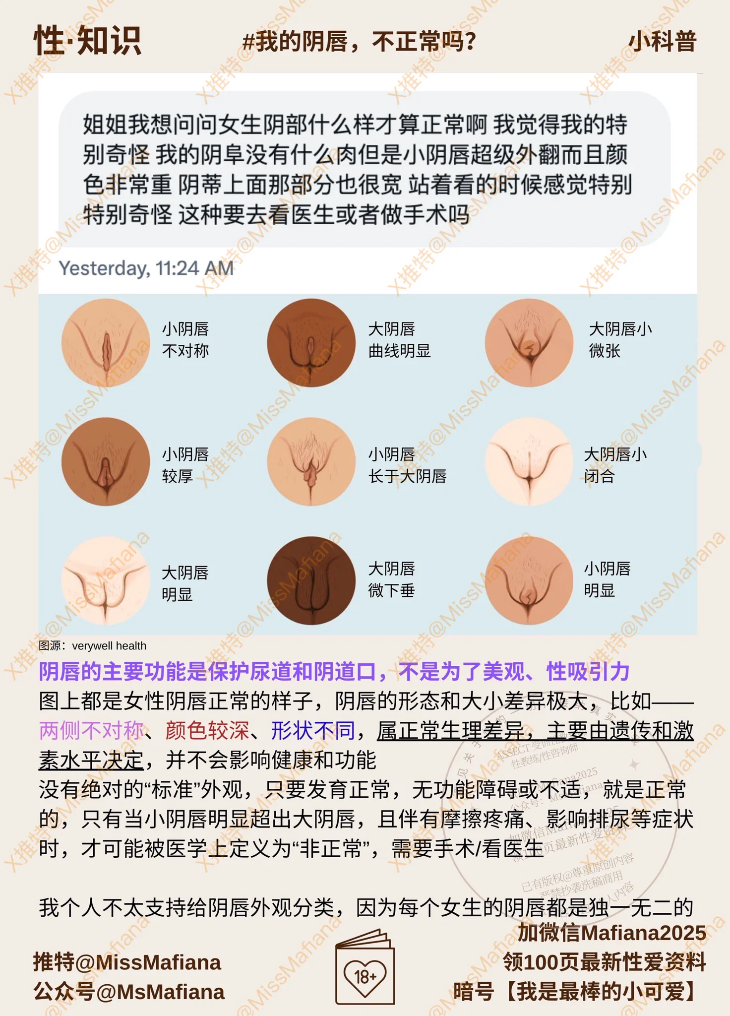 女生阴部“应该”什么样？🌟你的阴部什么样，女生的阴部就是什么样我高中到大学也因为自己阴部，看起来不好看，觉得自卑，觉得颜色深、皱巴巴、报看其实，它是保护阴道、尿道的，所谓的美观标准并非客观存在的，而是被后天塑造的，不要陷入这个焦虑陷阱🩷图上是各种阴唇形象，都是正常的 https://t.co/w9eD5ztqvt