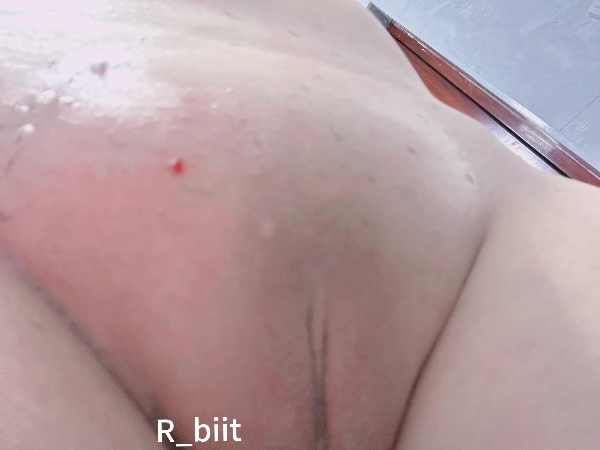 我去刮b毛刮破了一点 https://t.co/gI6YGCiCZK