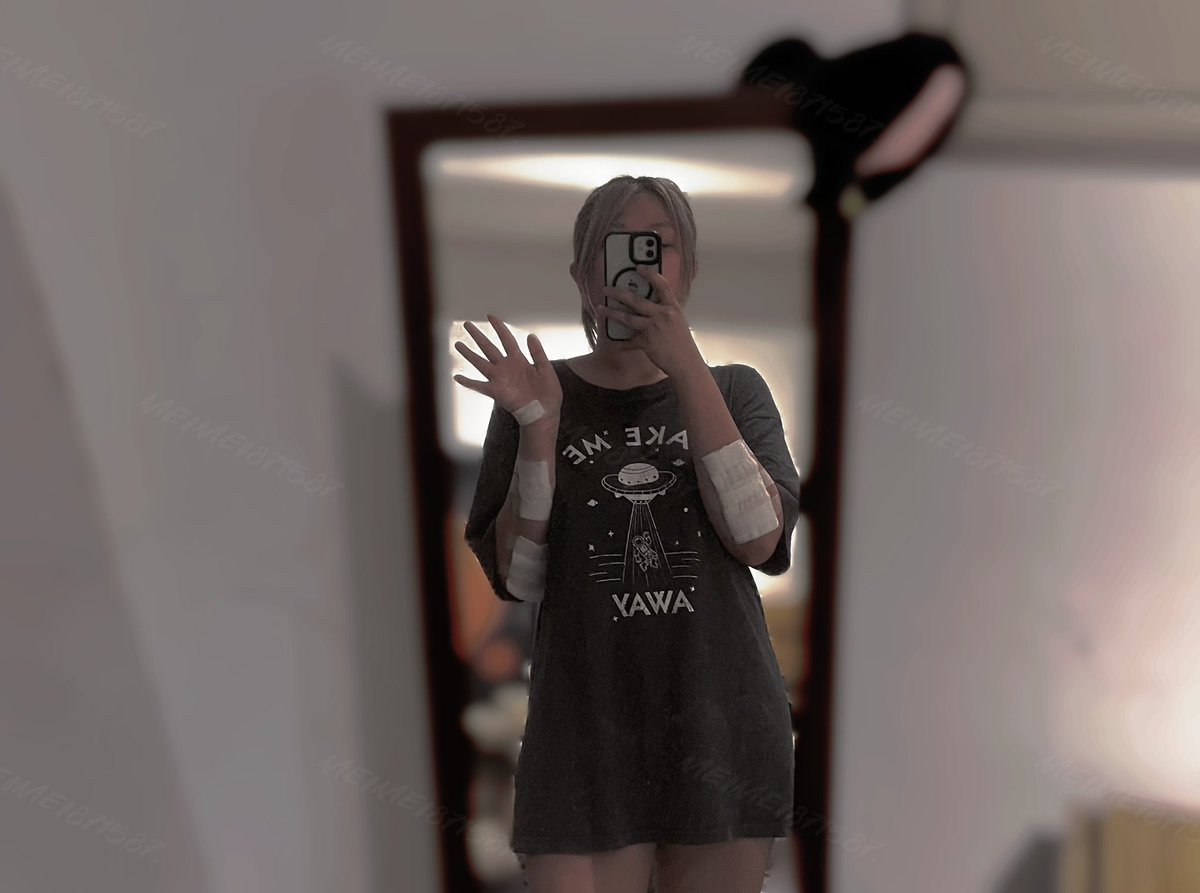 遇到酒駕肇事者 
先進場維修 (*´д`)

#牙齒也遭殃 
#歡迎抖內🫠 https://t.co/dacmdsBfrz